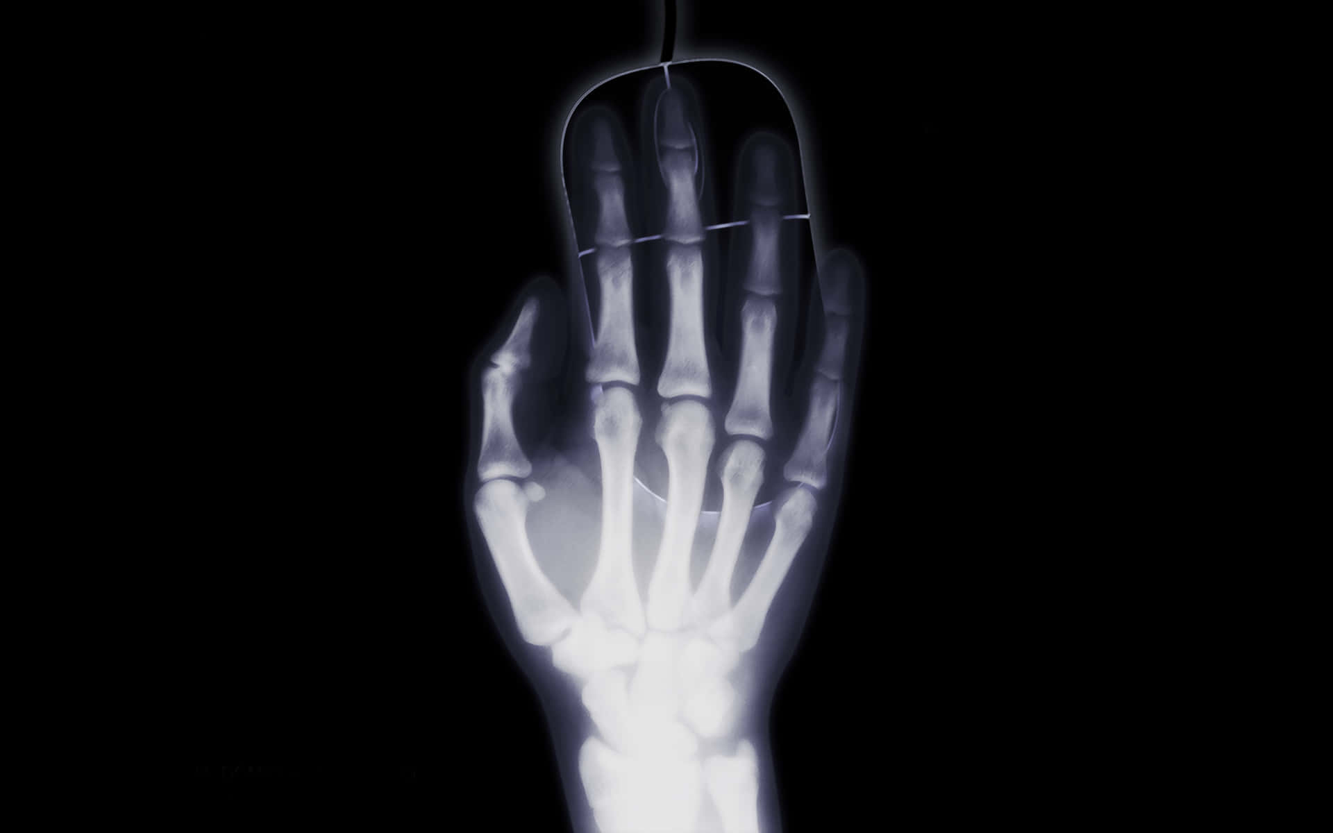 A Closeup X Ray Image Of A Human Hand Background