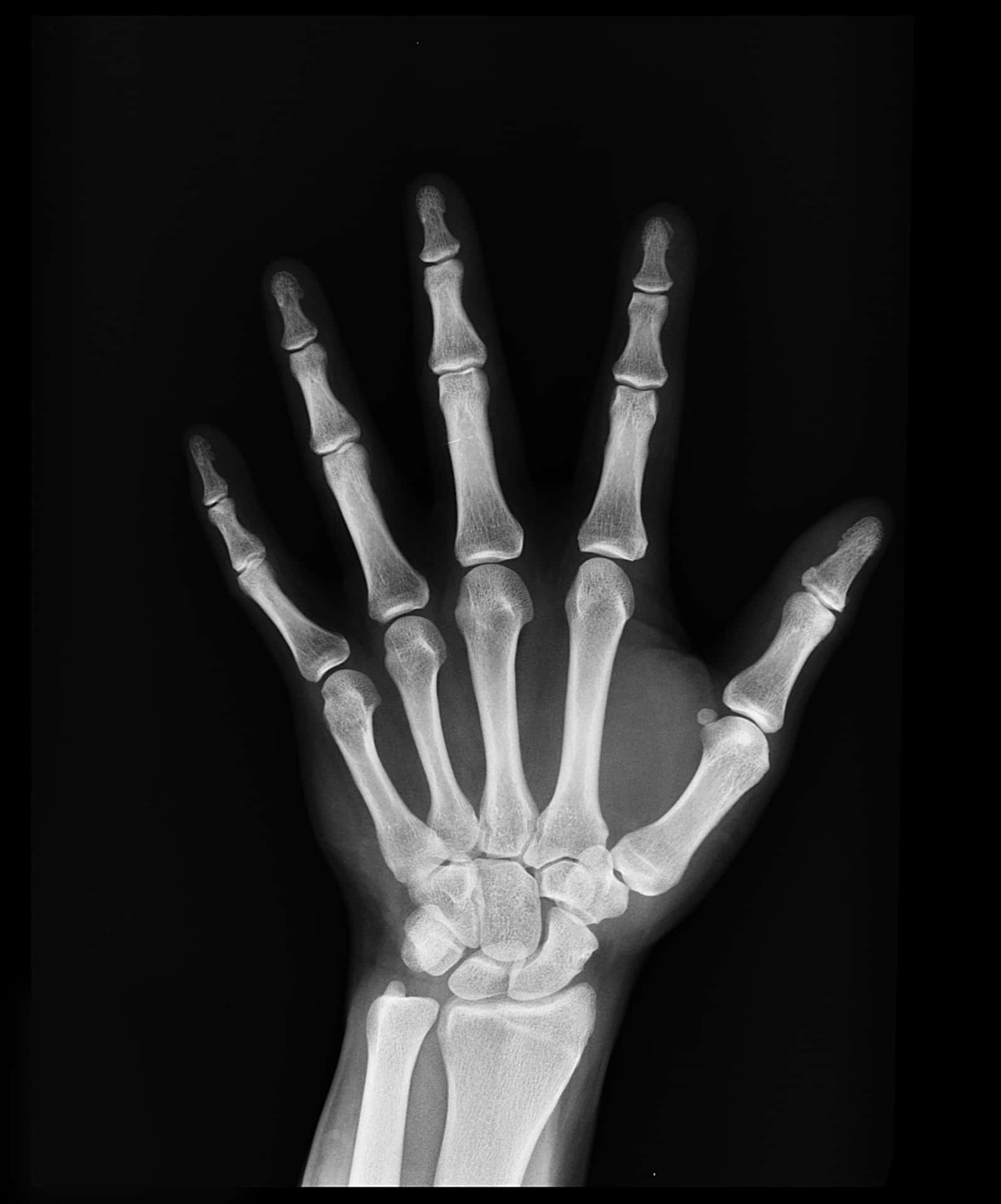 A Hand With A Skeleton In It Background
