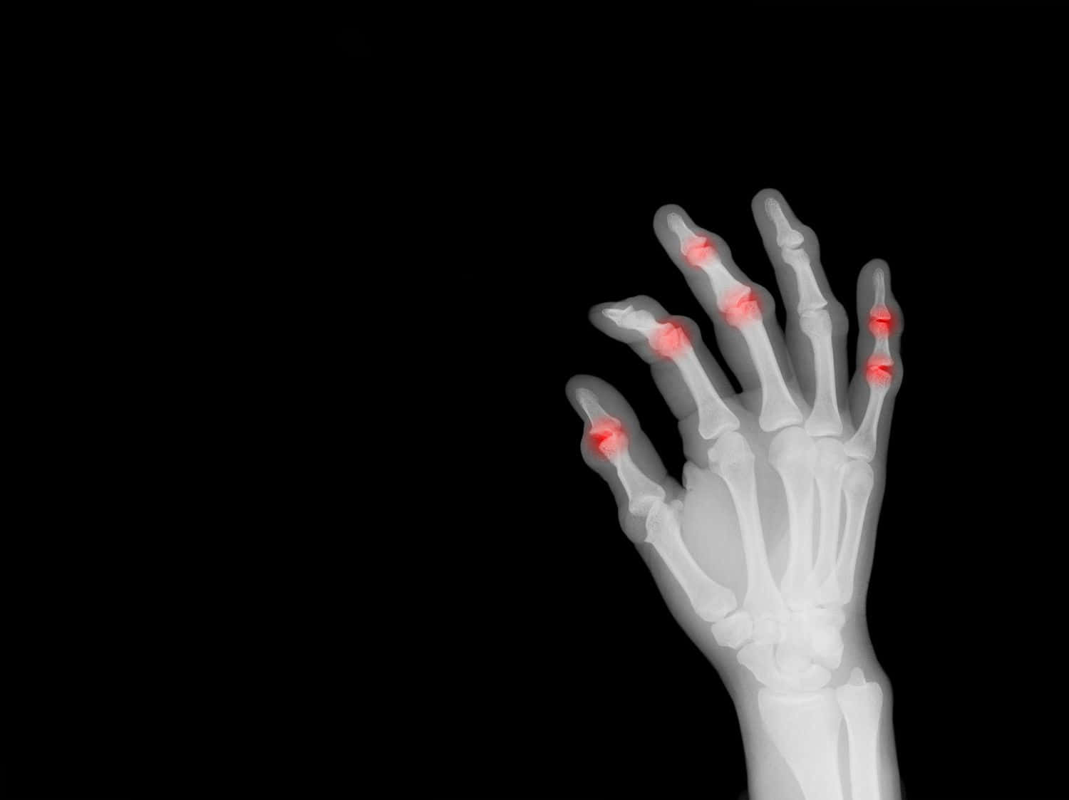 A Hand With A X - Ray Showing A Finger With A Red Spot Background