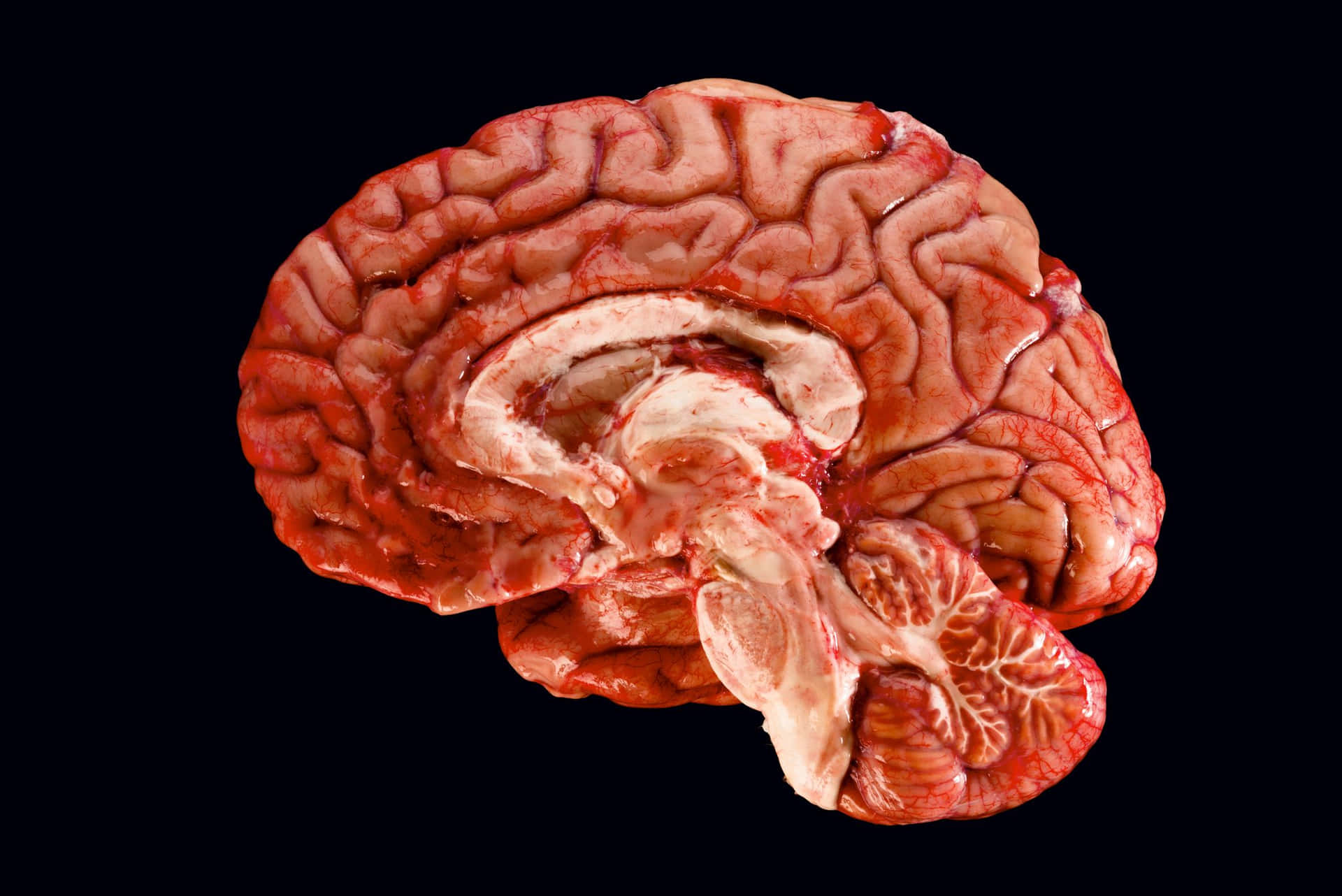 A Human Brain Is Shown On A Black Background Background