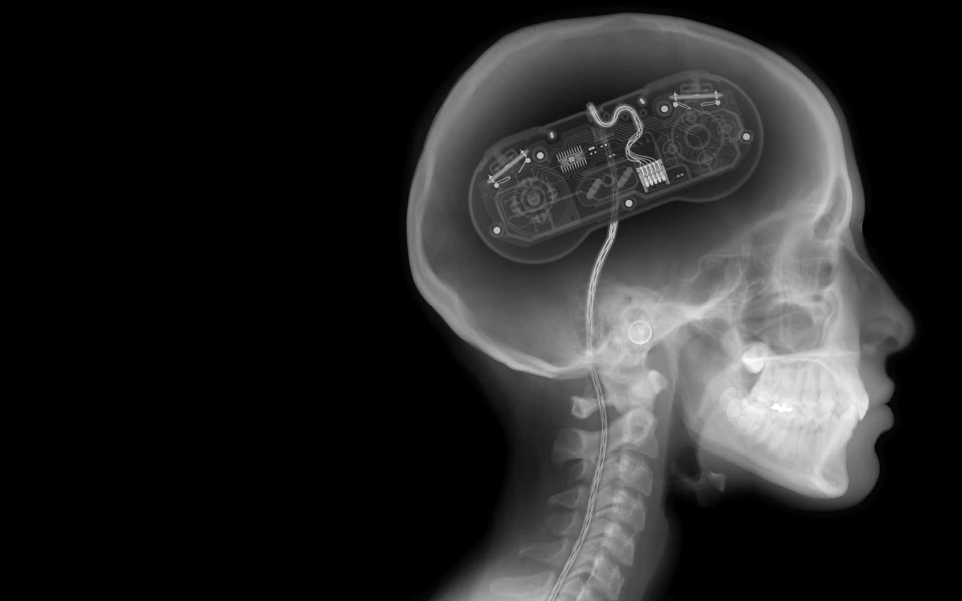 A Person's Head Is Shown With A Video Game Controller