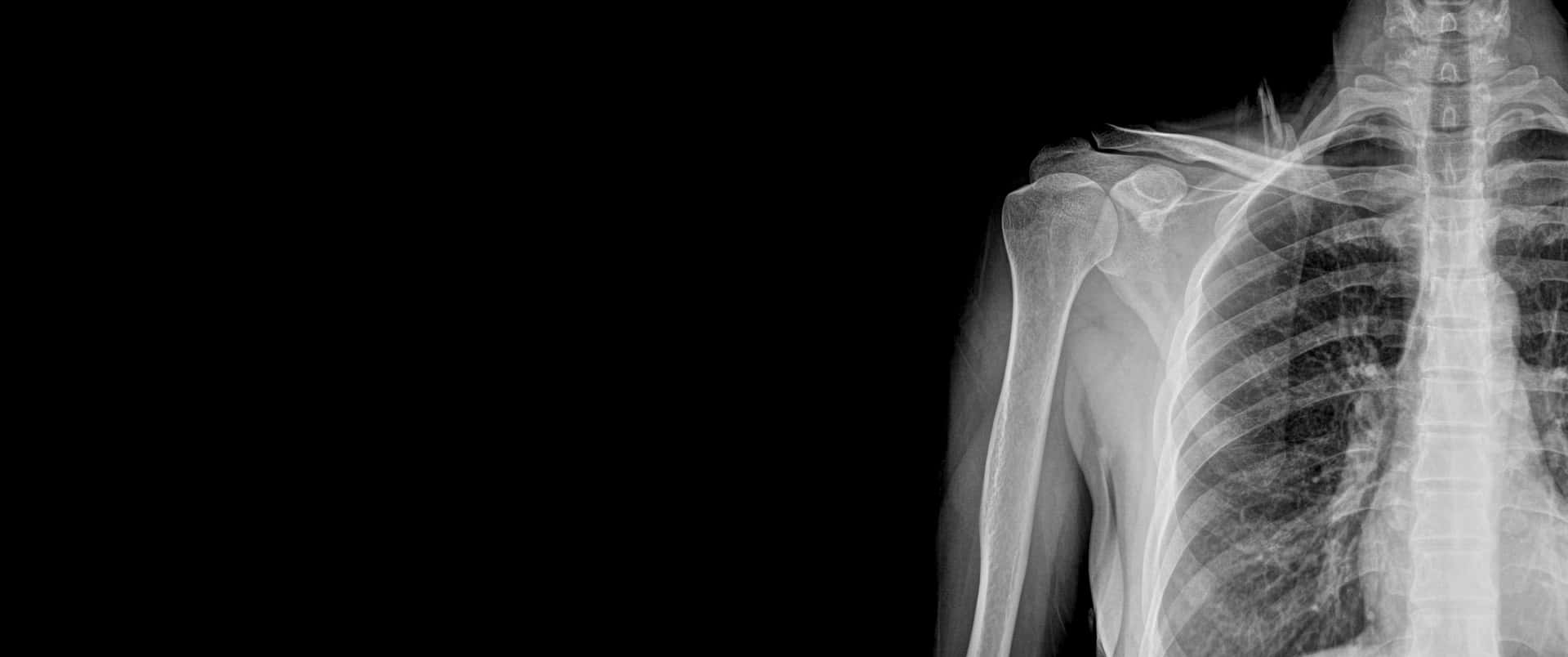 A X - Ray Of A Person's Chest Background