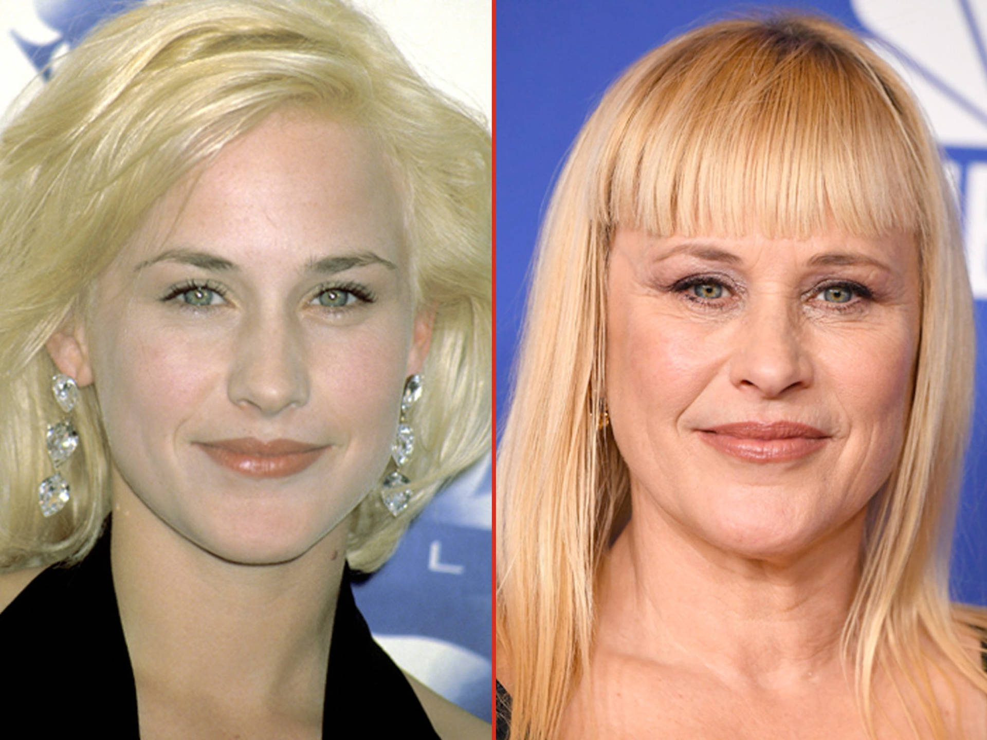 Actress Patricia Arquette Now And Then Background