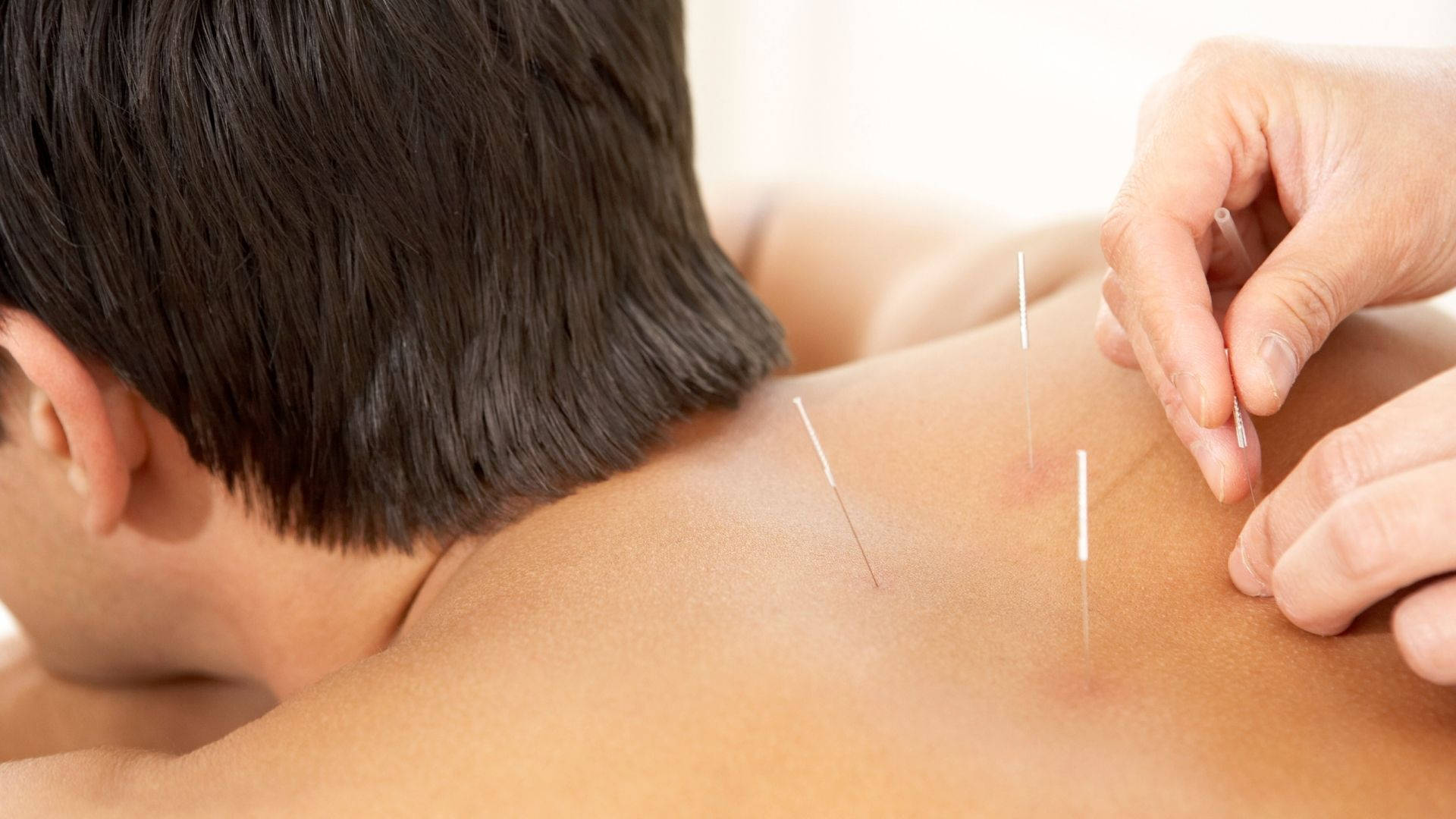 Acupuncturist Alternative Medicine Background