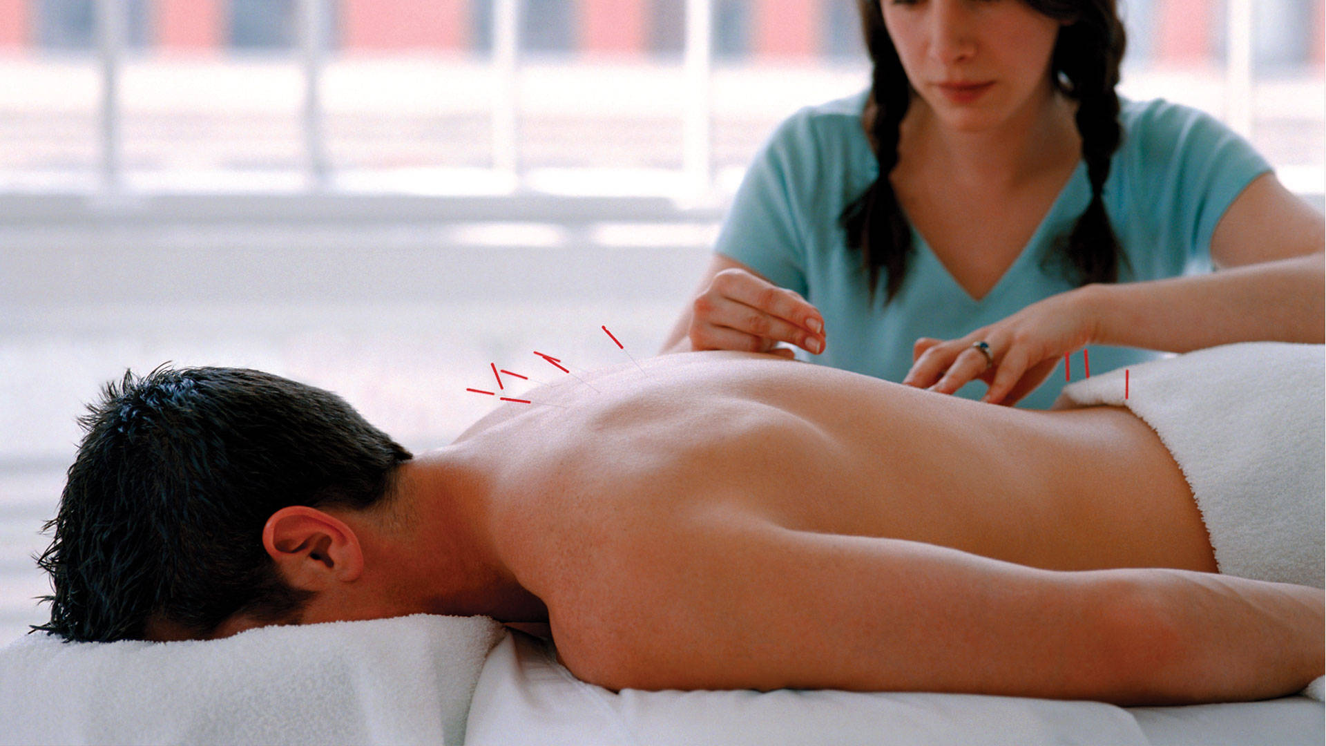 Acupuncturist Back Needle Insertion