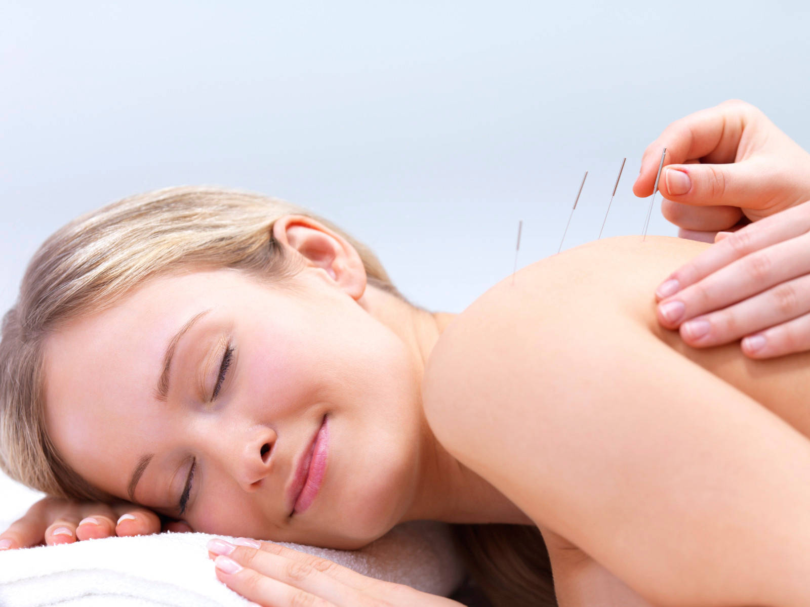 Acupuncturist Back Needle Therapy