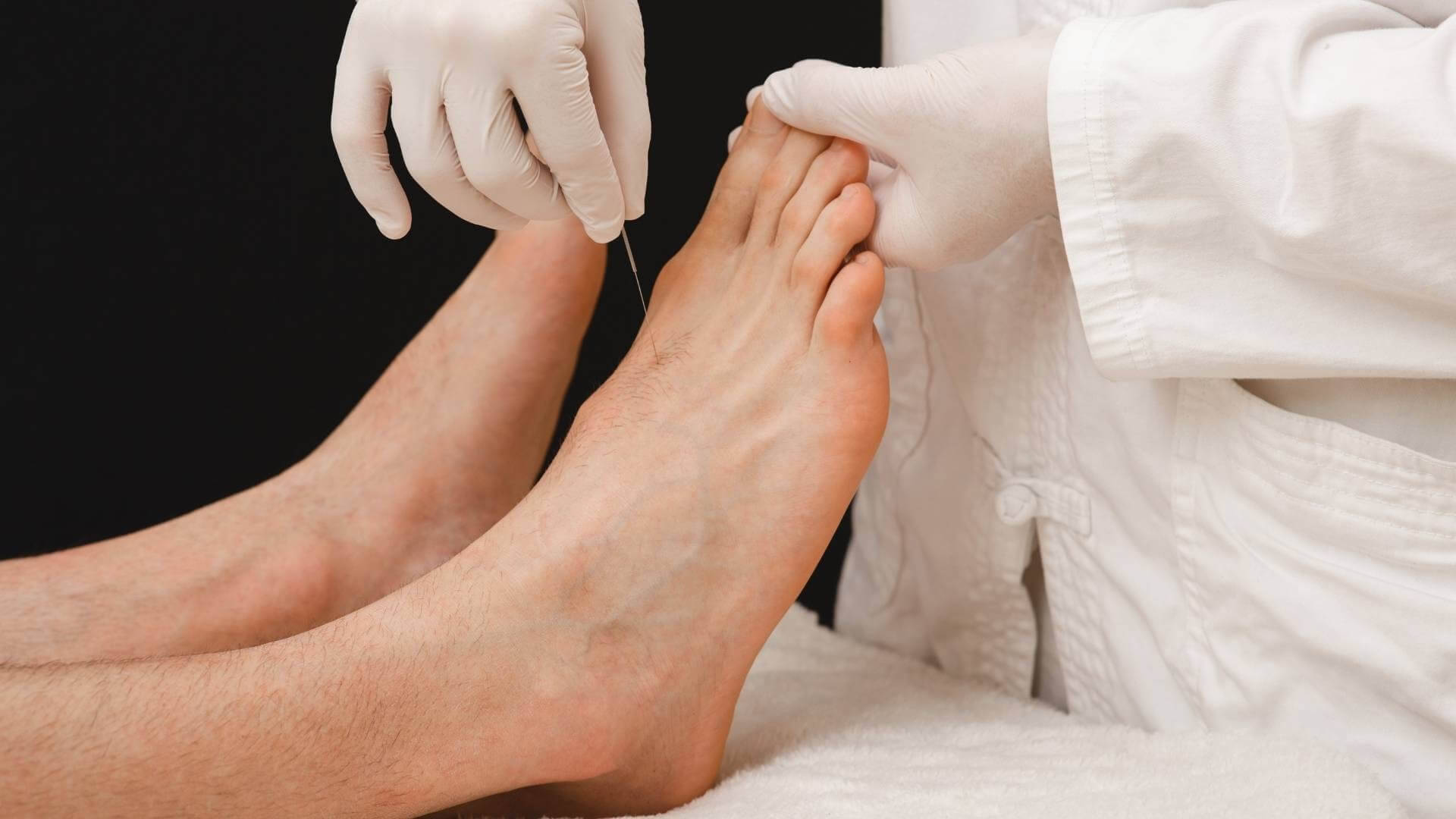 Acupuncturist Feet Needle Treatment Background