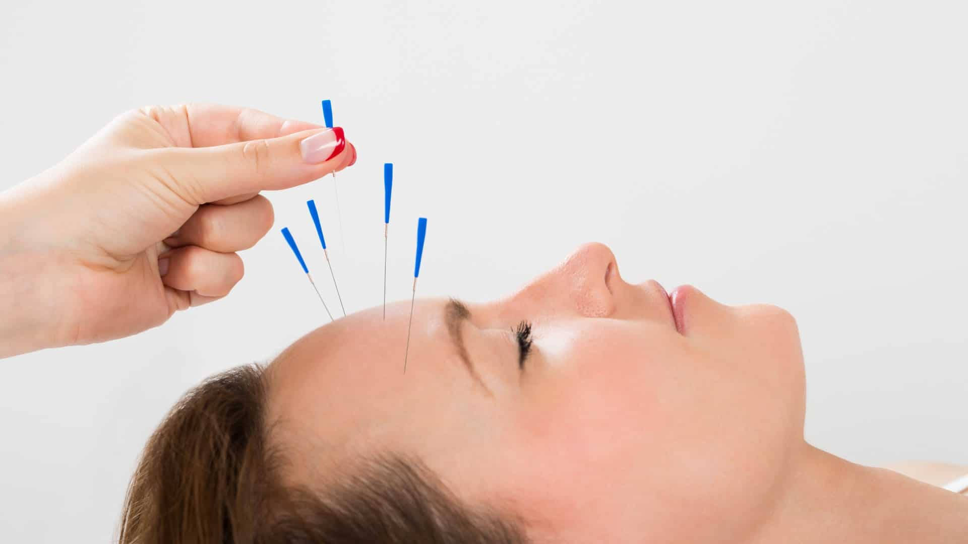 Acupuncturist Head Treatment Background