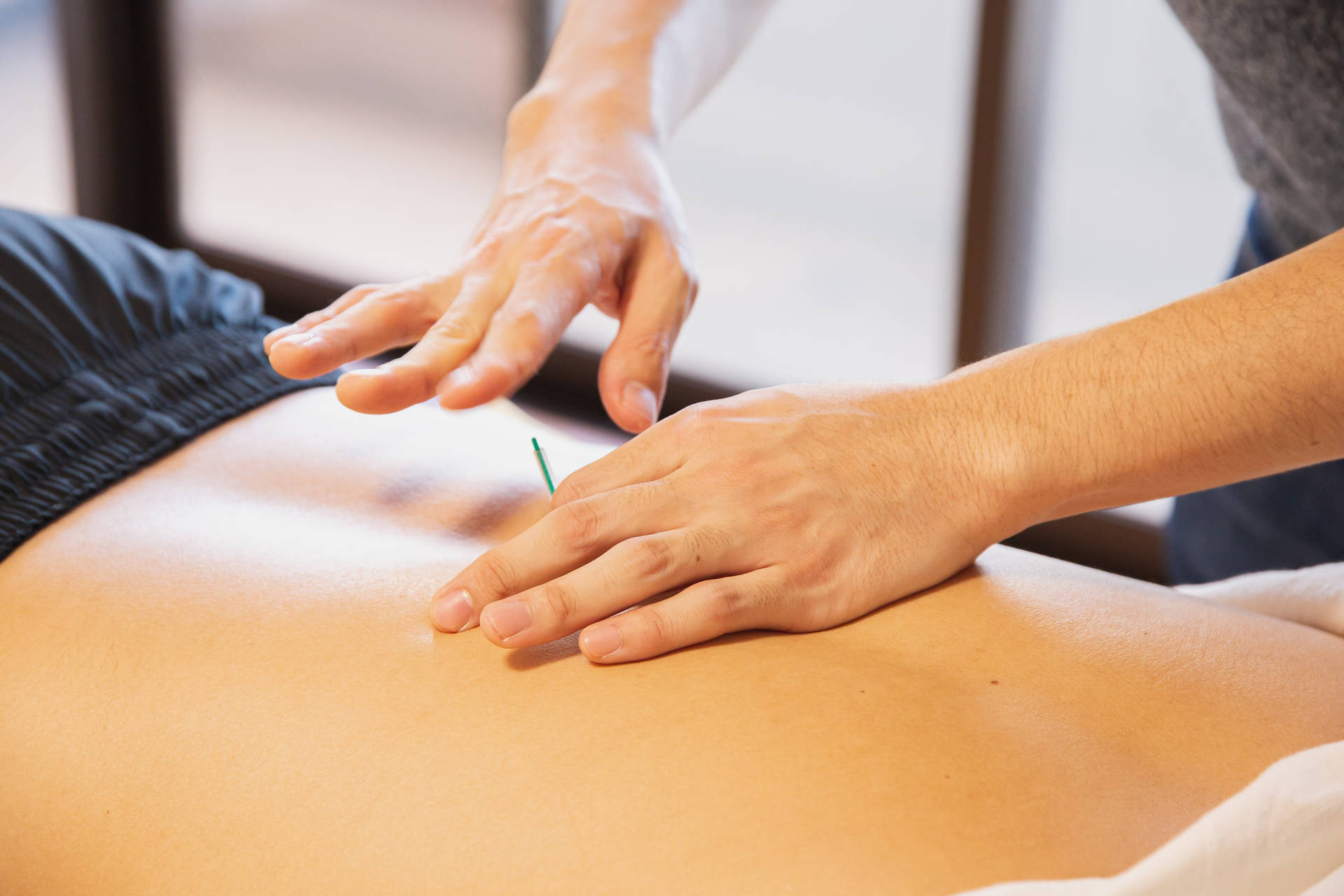 Acupuncturist Inserting Needle Through Back Skin Background