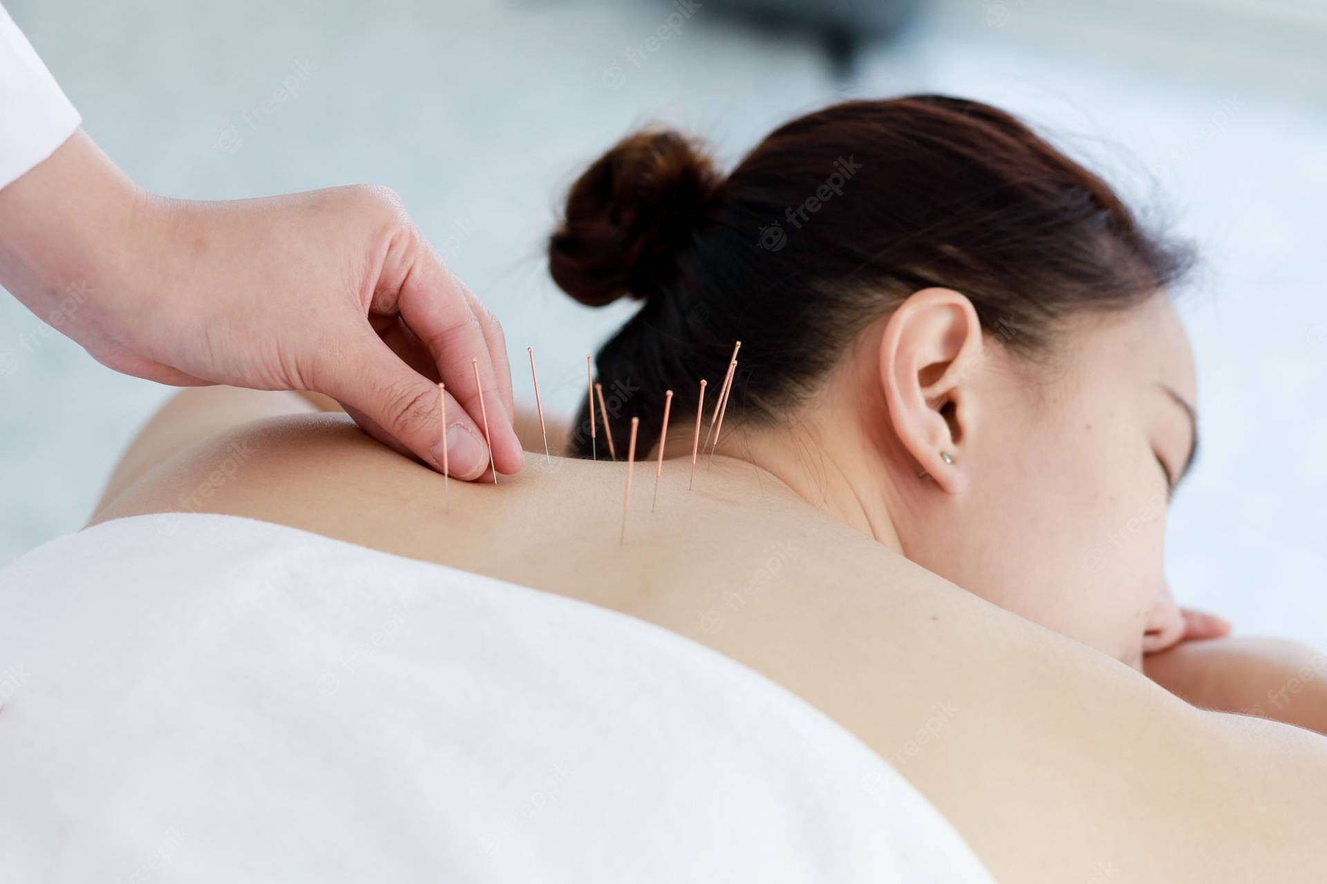 Acupuncturist Neck Therapy Background