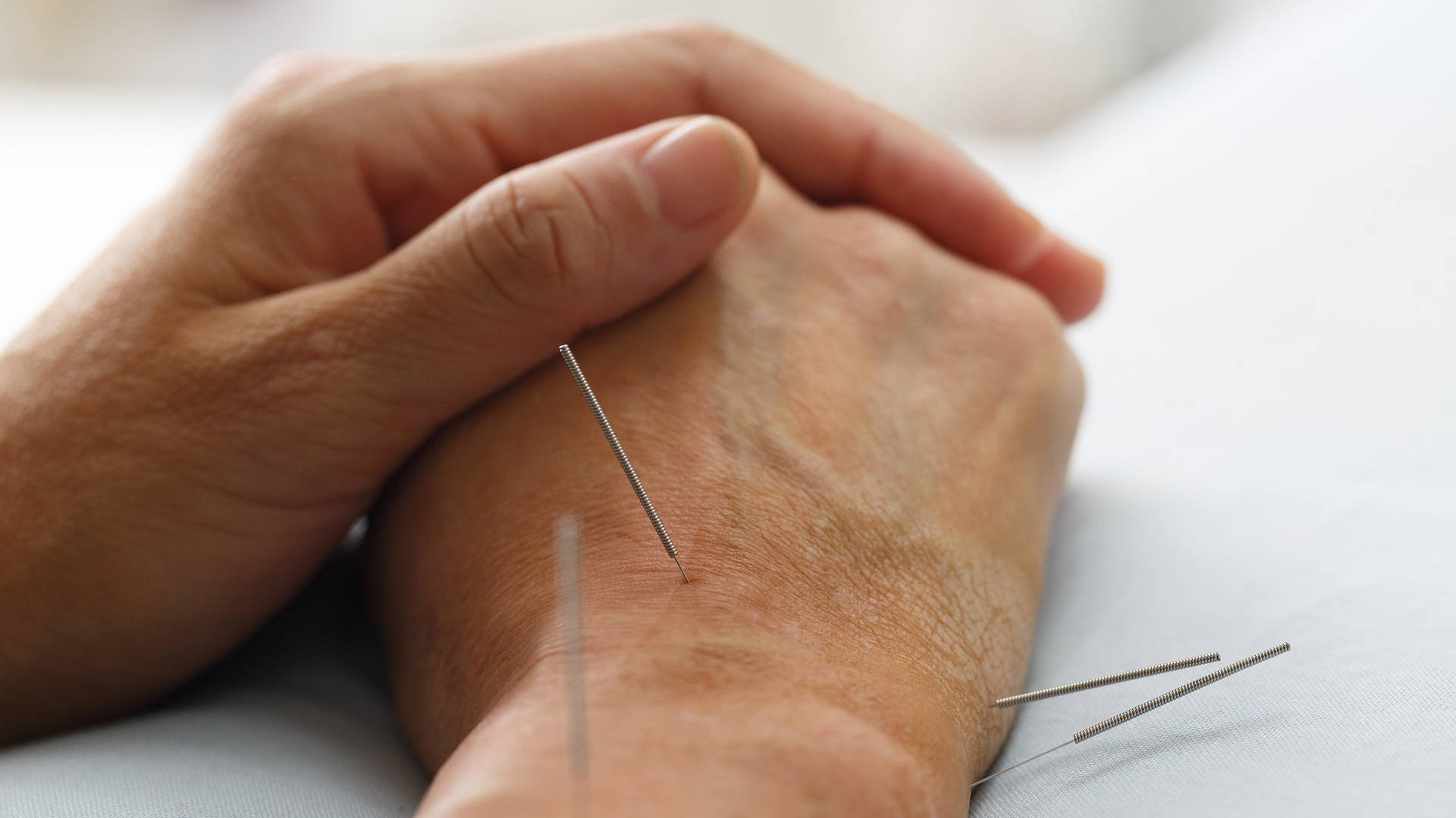 Acupuncturist Performing Hand Therapy Background