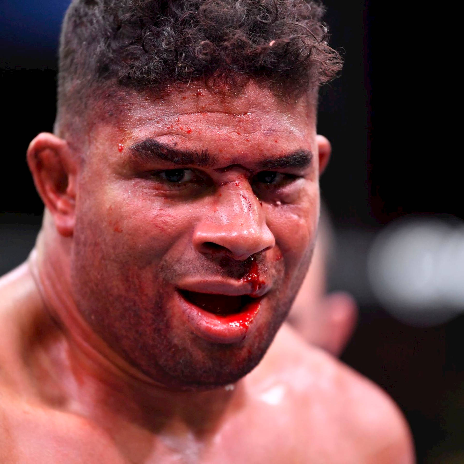 Alistair Overeem Endures A Hard Fight Background