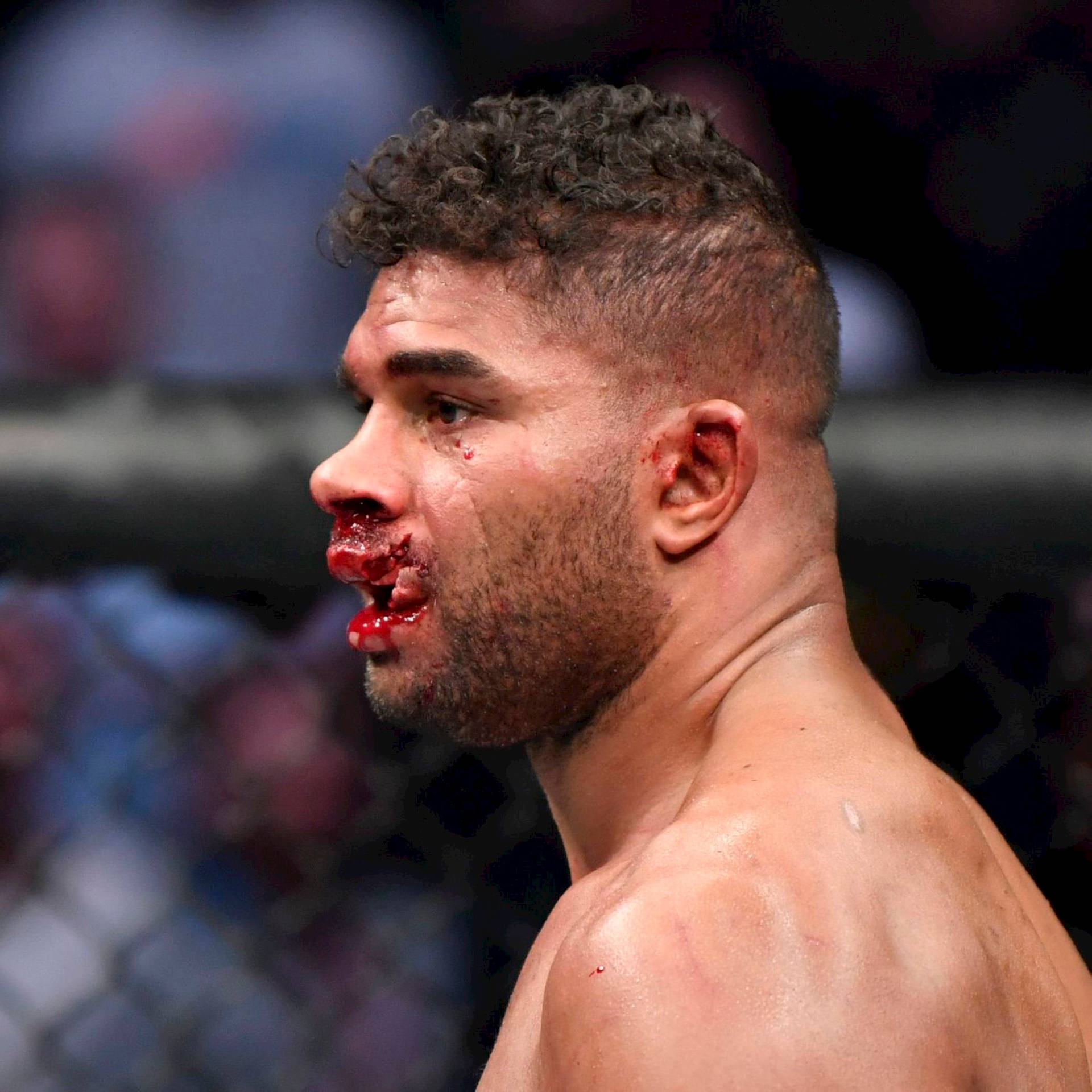 Alistair Overeem With Bloody Face Background