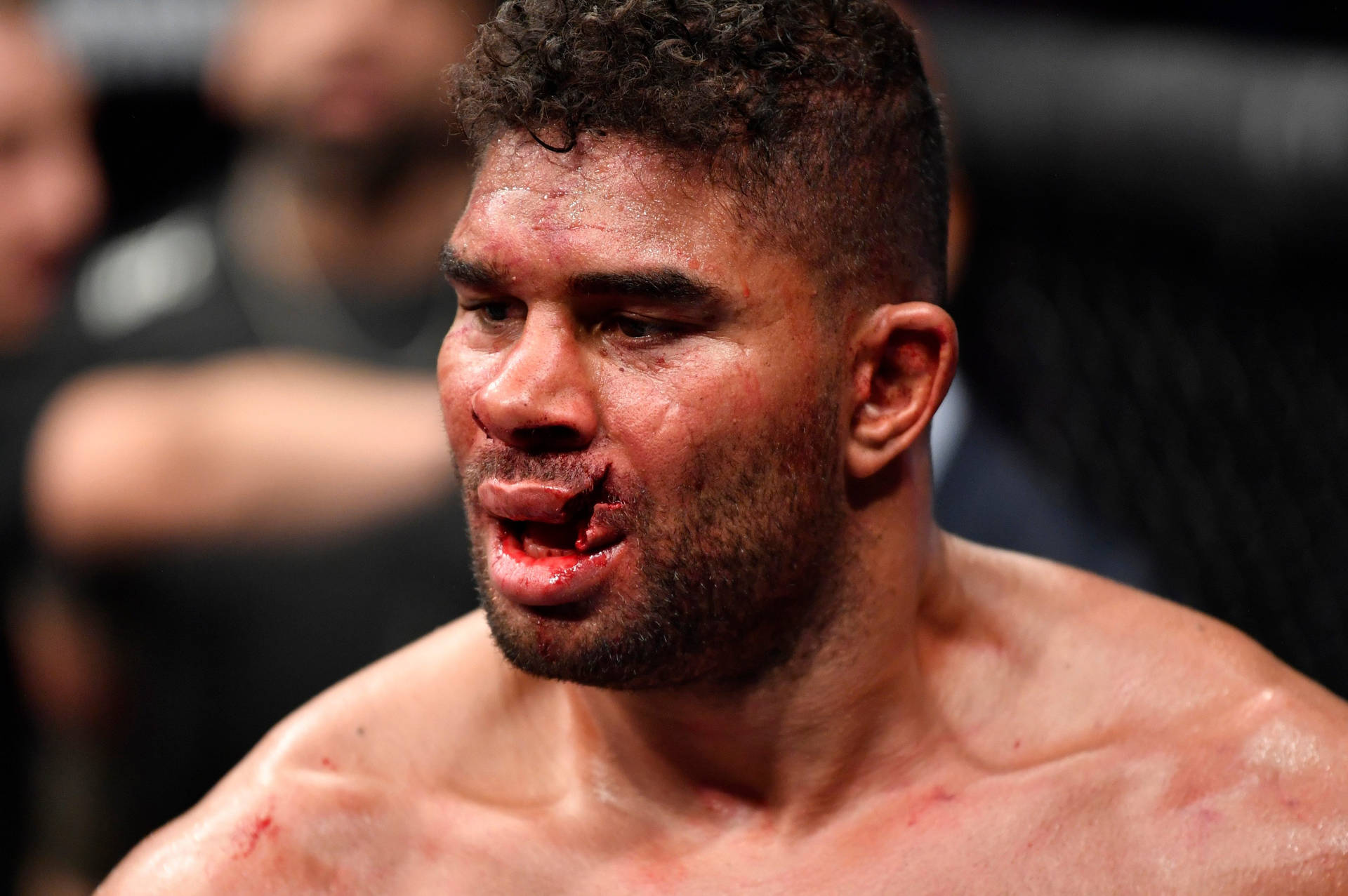 Alistair Overeem With Split Lips Background