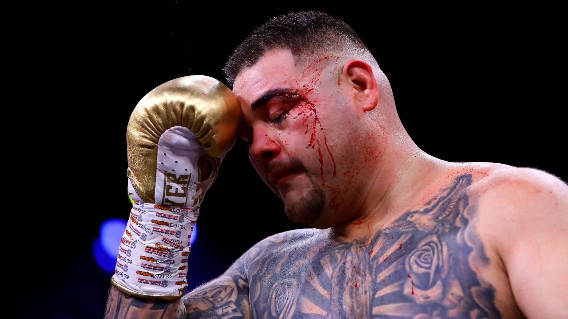 Andy Ruiz Bloody Eye