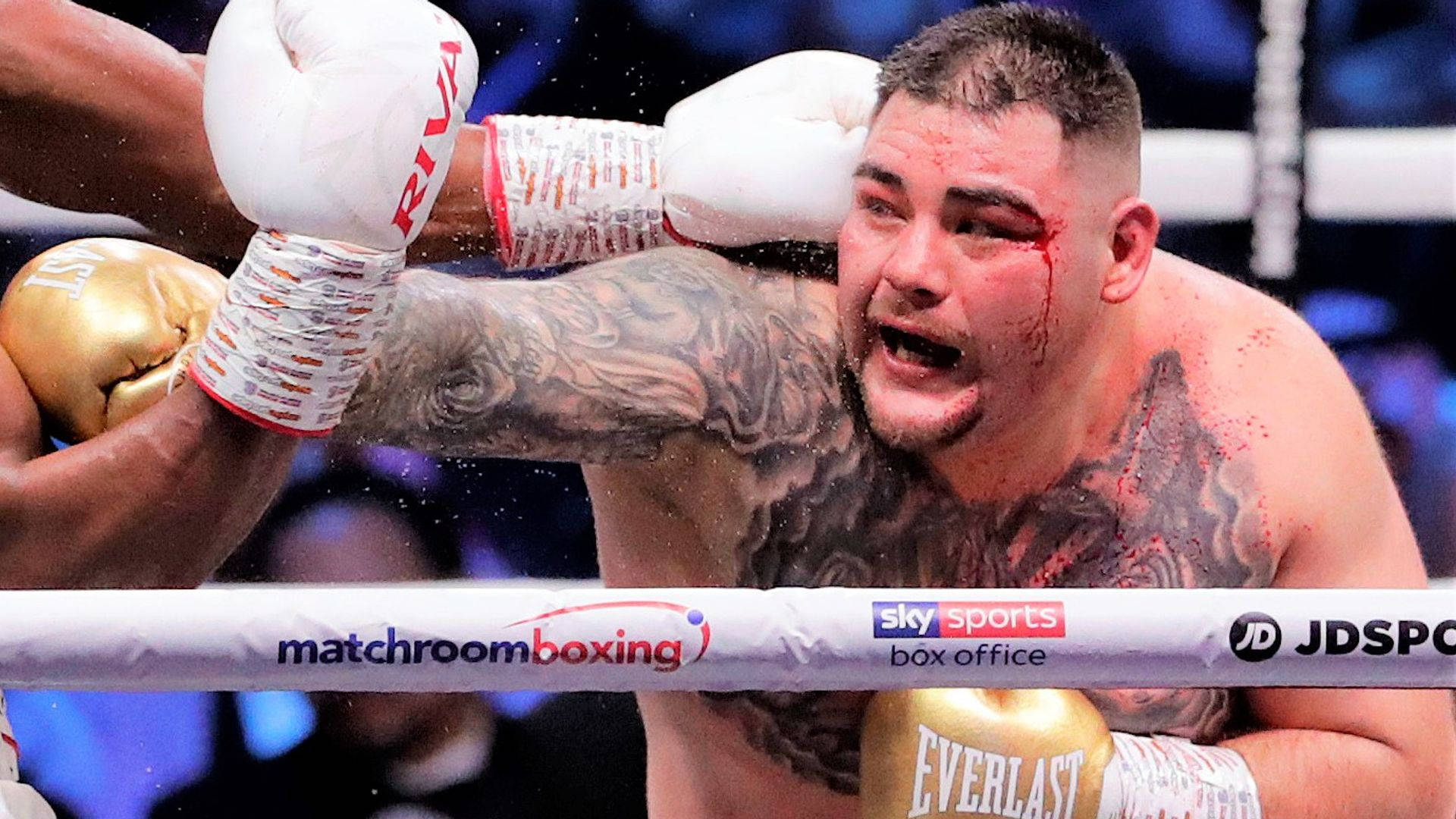 Andy Ruiz Eye Injury