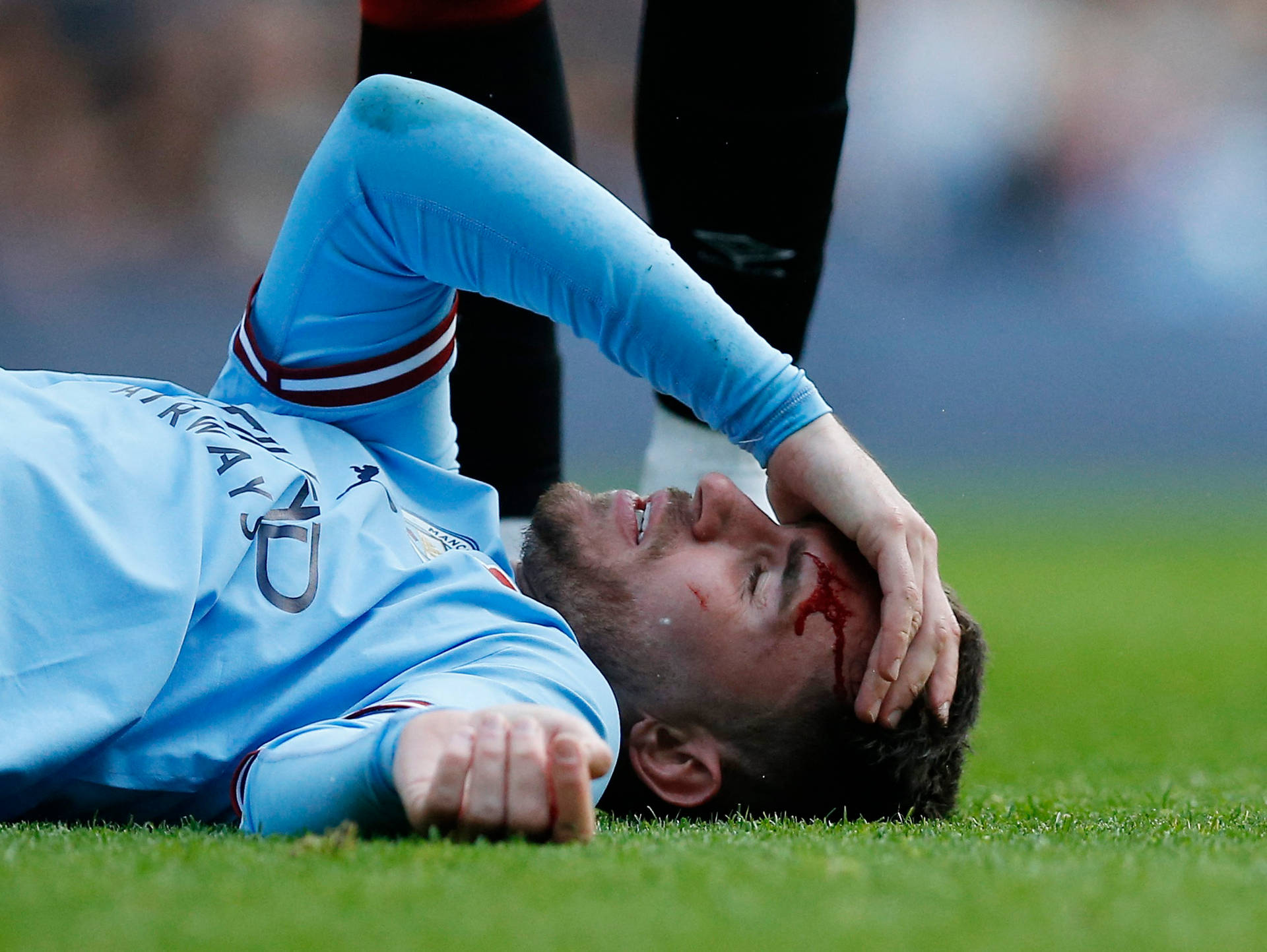 Aymeric Laporte With Wounded Head Background