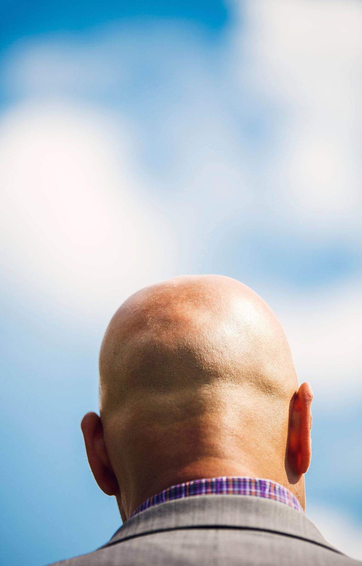 Bald Man And Blue Sky Background