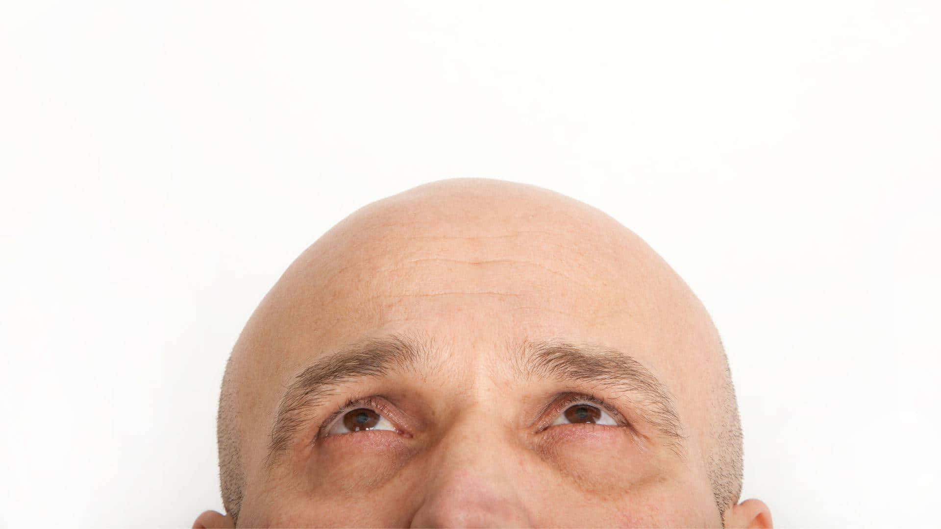 Bald Man Looking Upward Background