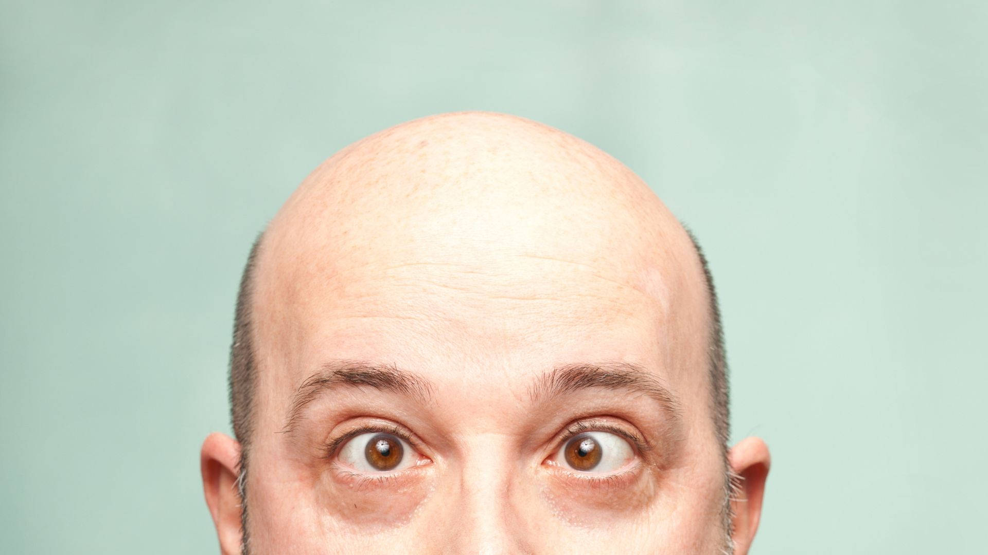 Bald Man With Crossed Eyes Background