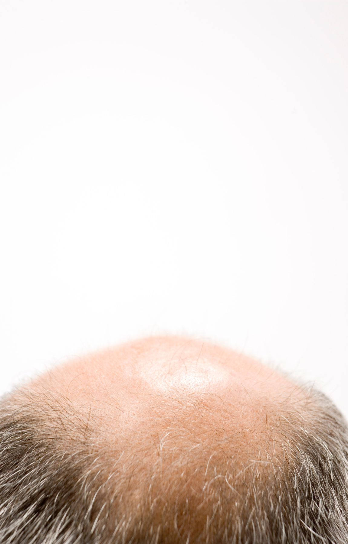 Bald Man With Thinning White Hair Background