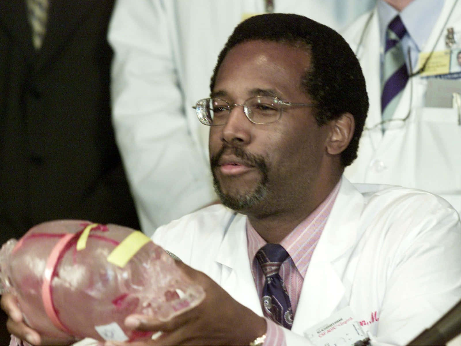 Ben Carson Young Background