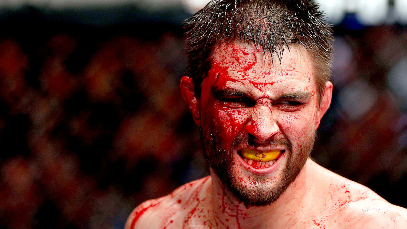 Bloody Professional Mixed Martial Artist Carlos Condit Background