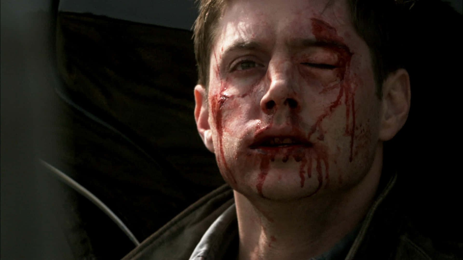 Bruised And Bloody Man