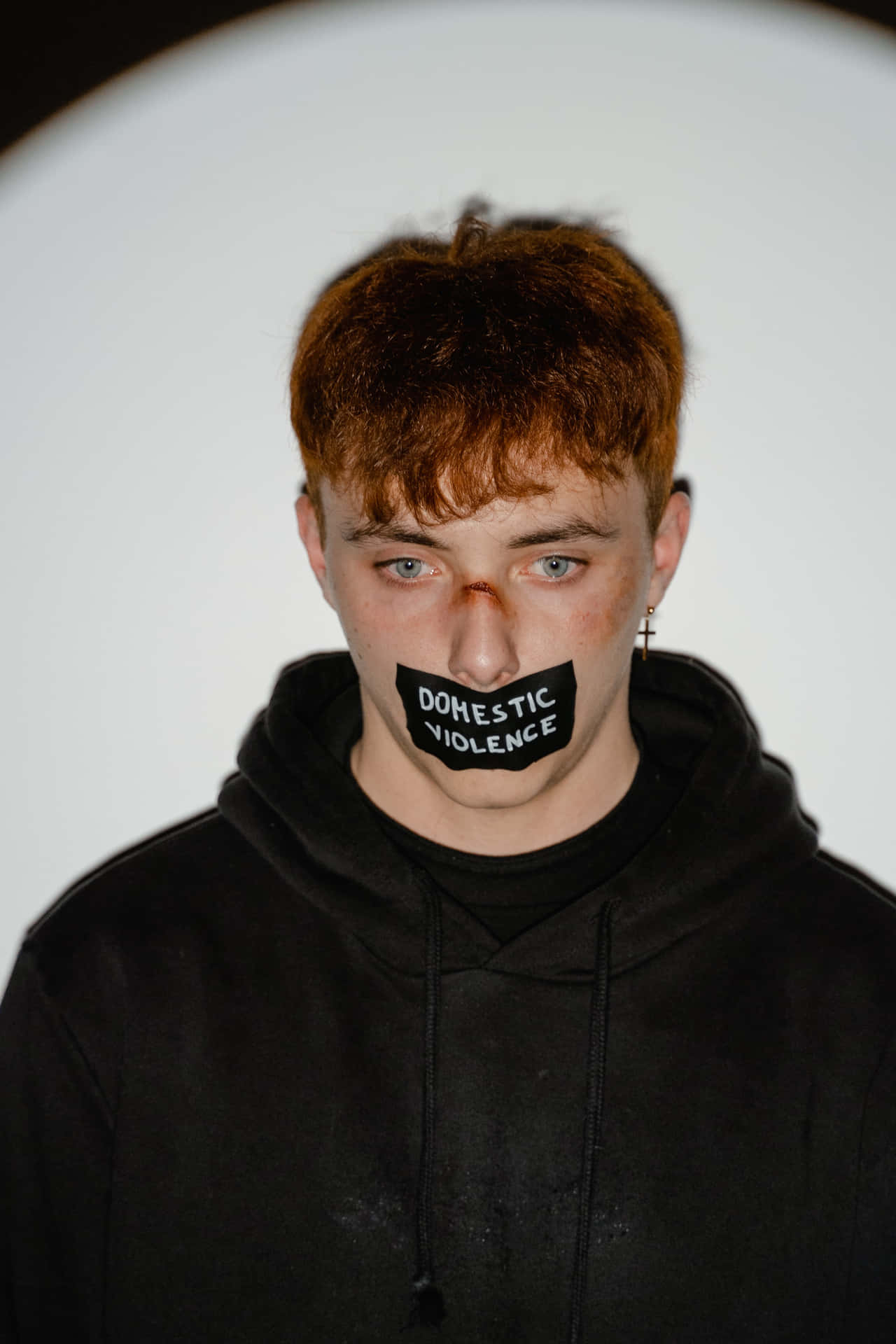 Bruised Boy With Sign