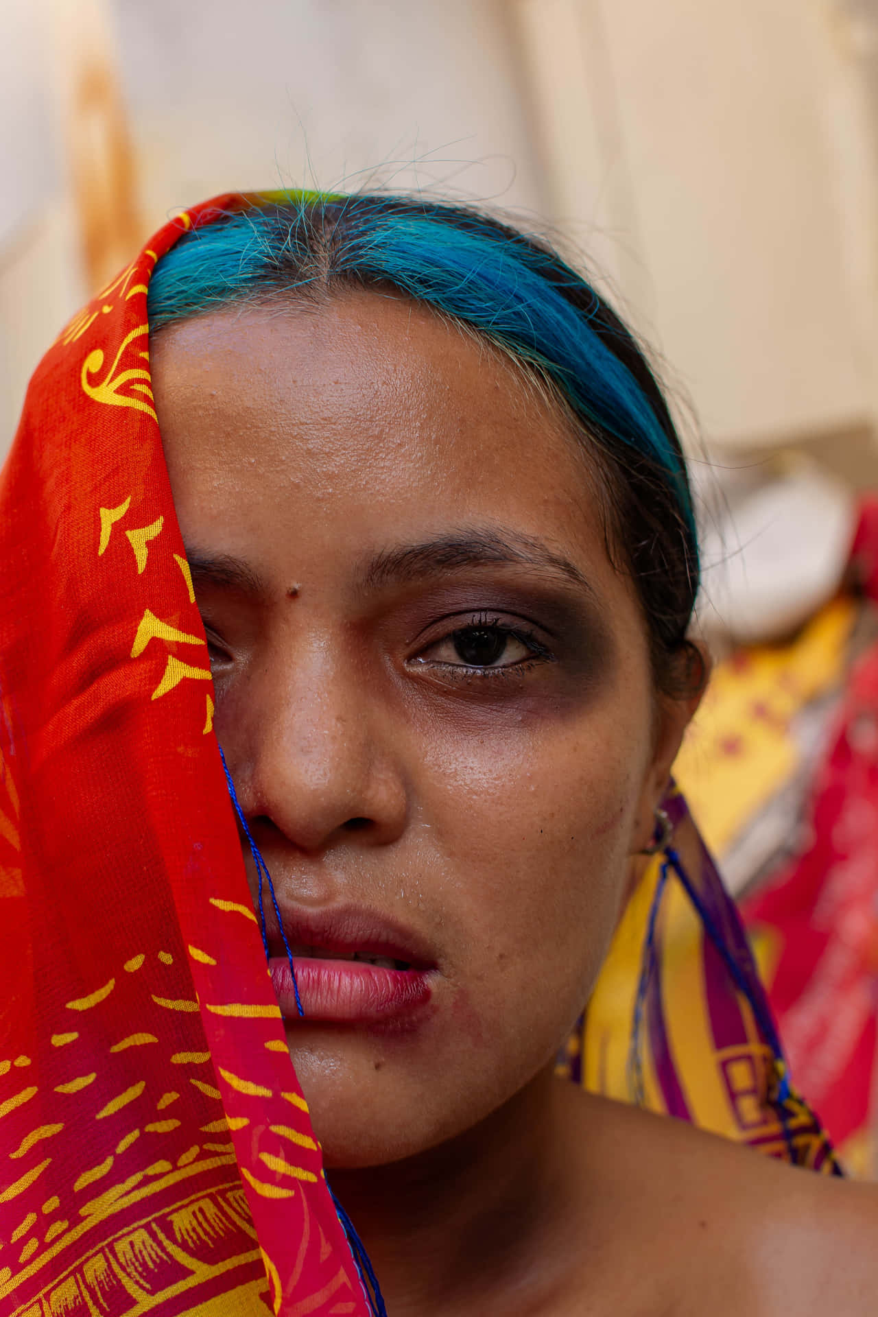 Bruised Girl Covering Face Background
