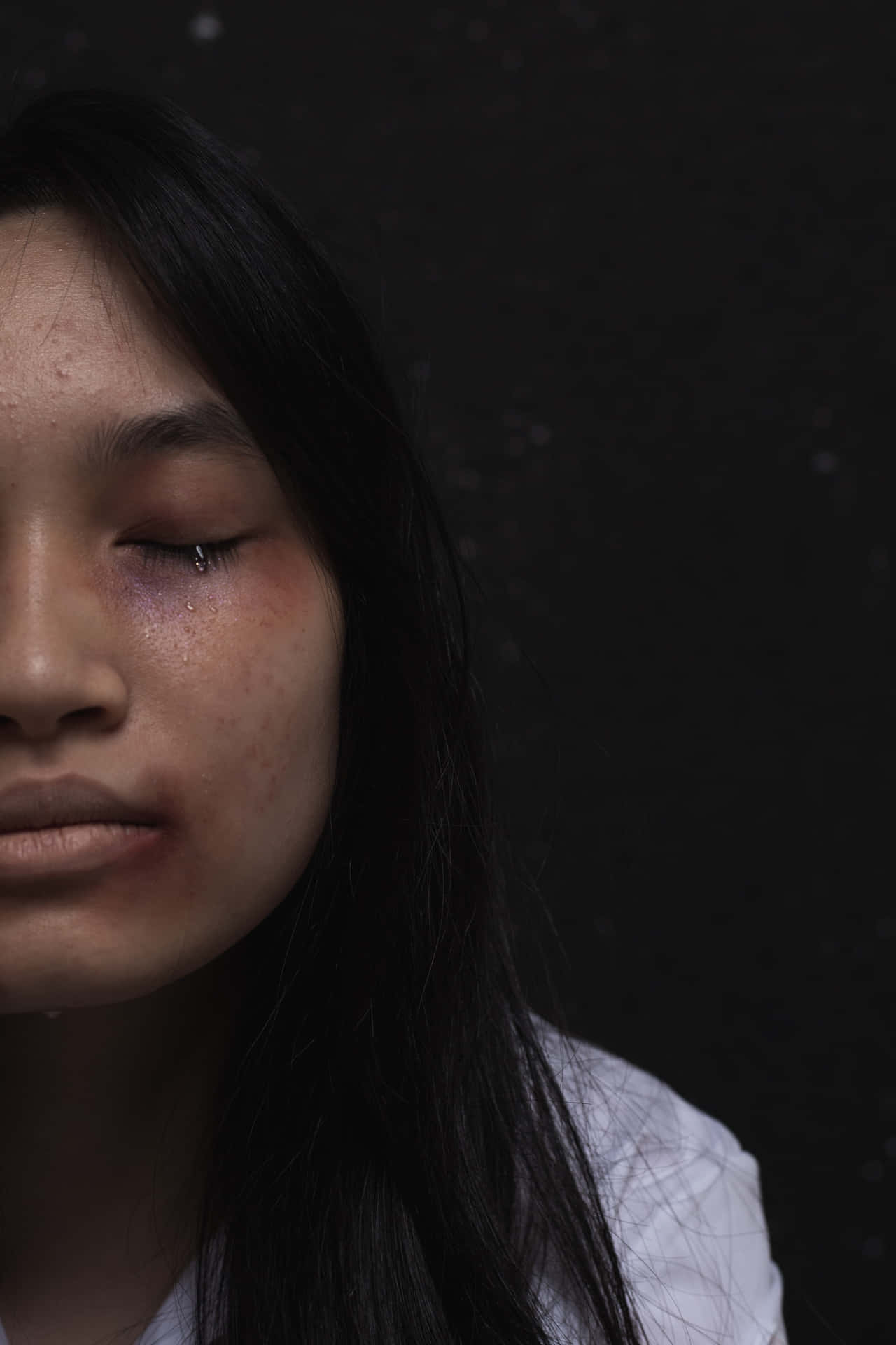 Bruised Girl Crying