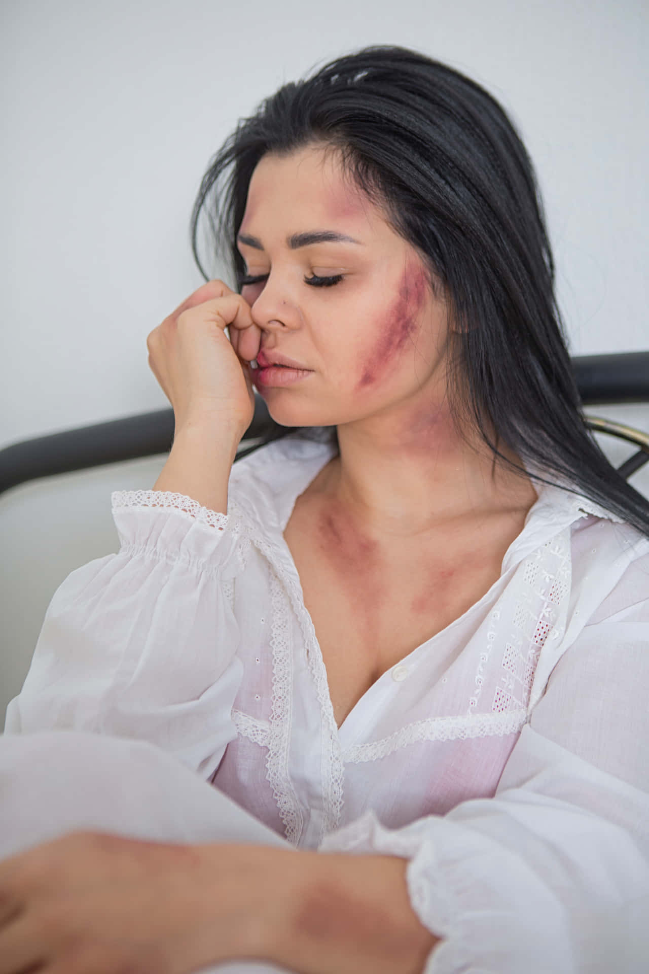 Bruised Girl In White Polo Background
