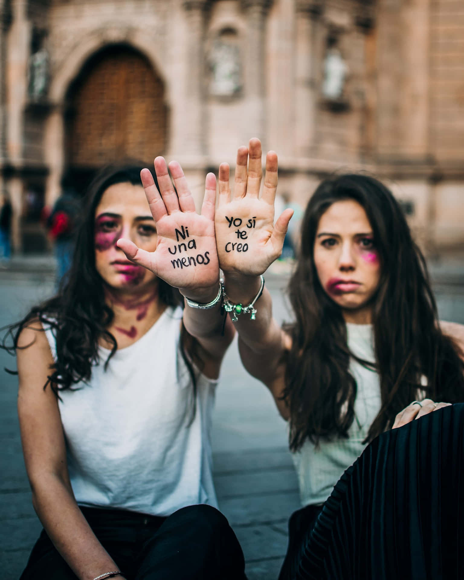 Bruised Girls Showing Their Palms