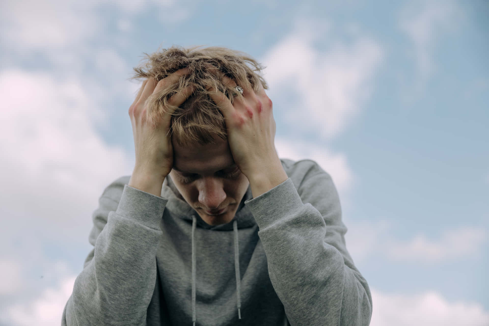 Bruised Man Holding Head Background