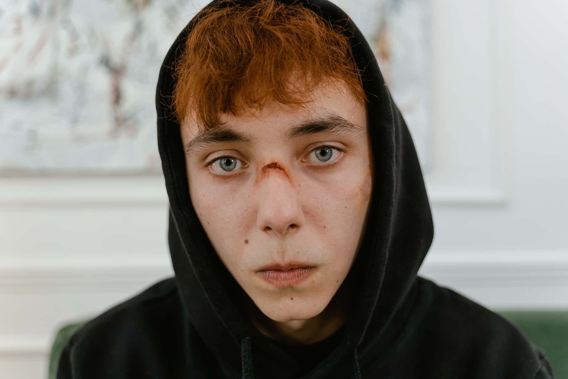 Bruised Redhead Man