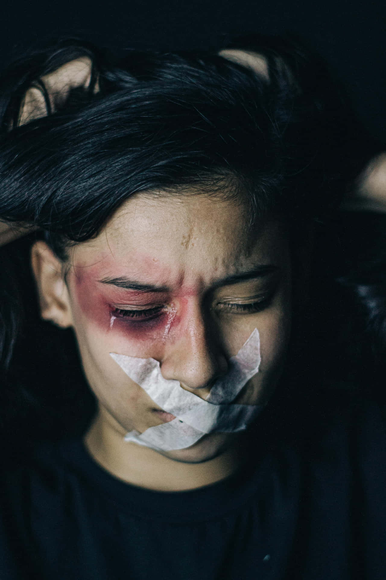 Bruised With Tape On Mouth Background