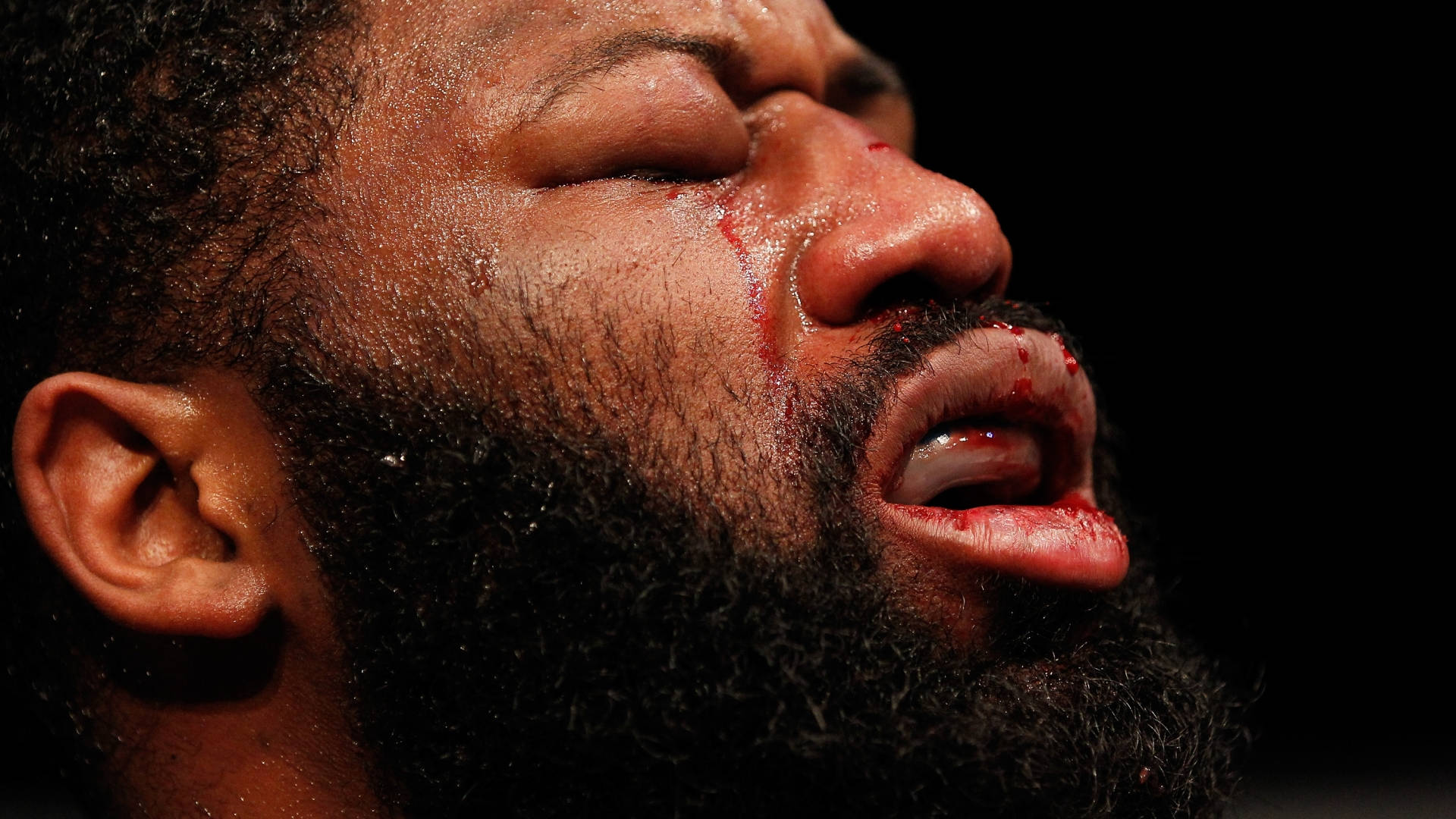 Curtis Blaydes Swollen Eyes