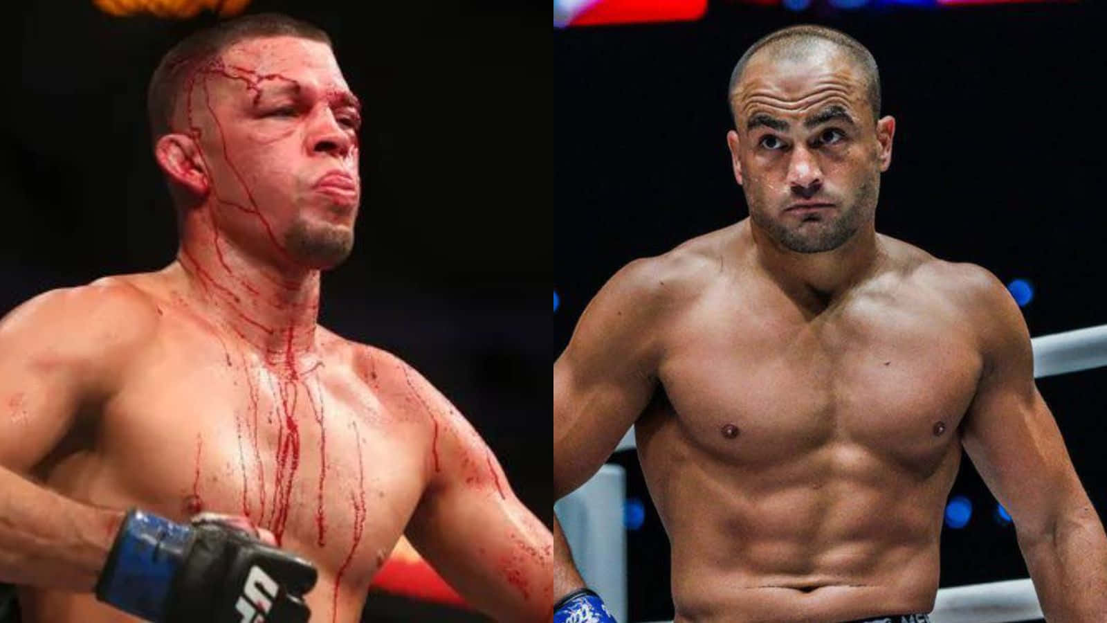 Diaz Versus Eddie Alvarez Fight