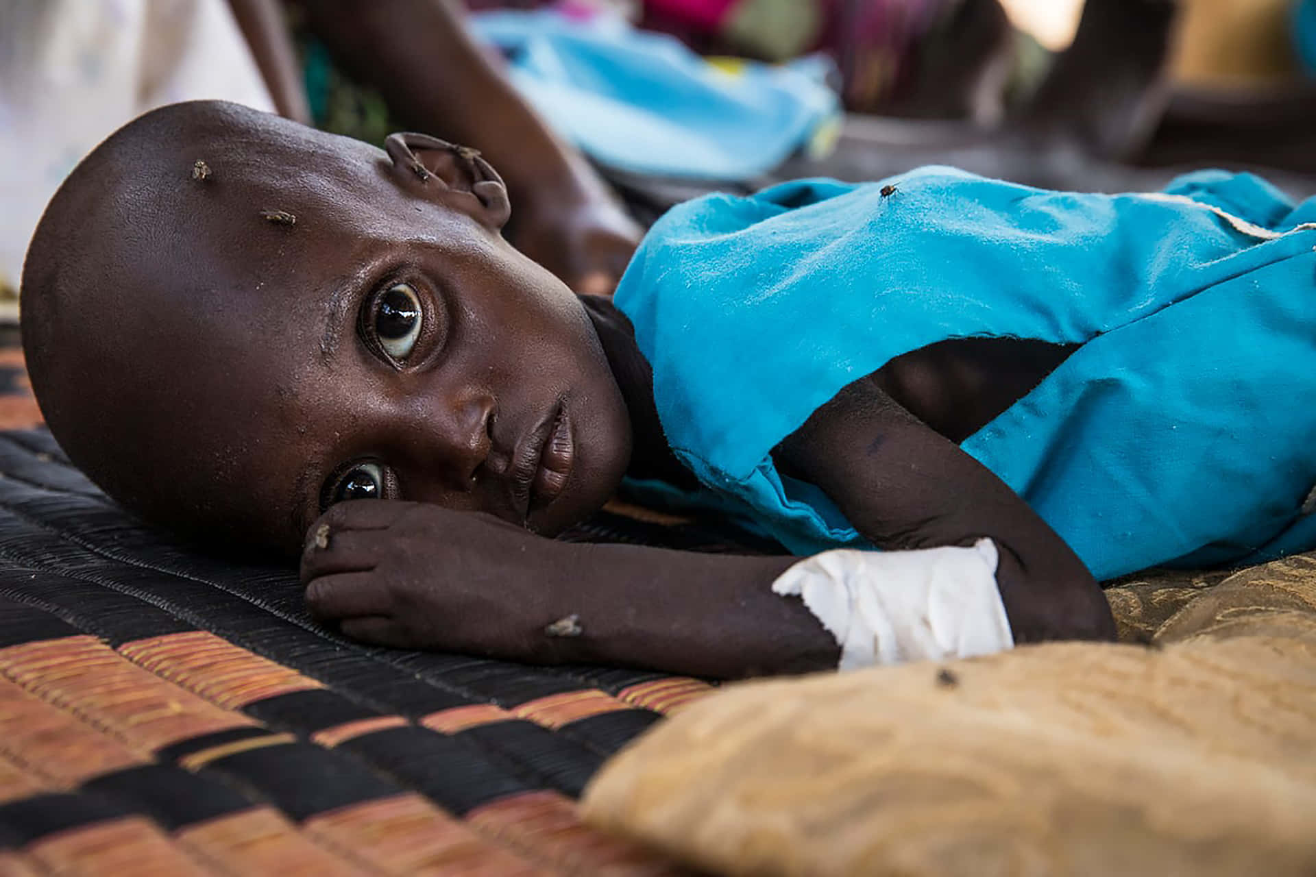 Emaciated Child With Big Eyes