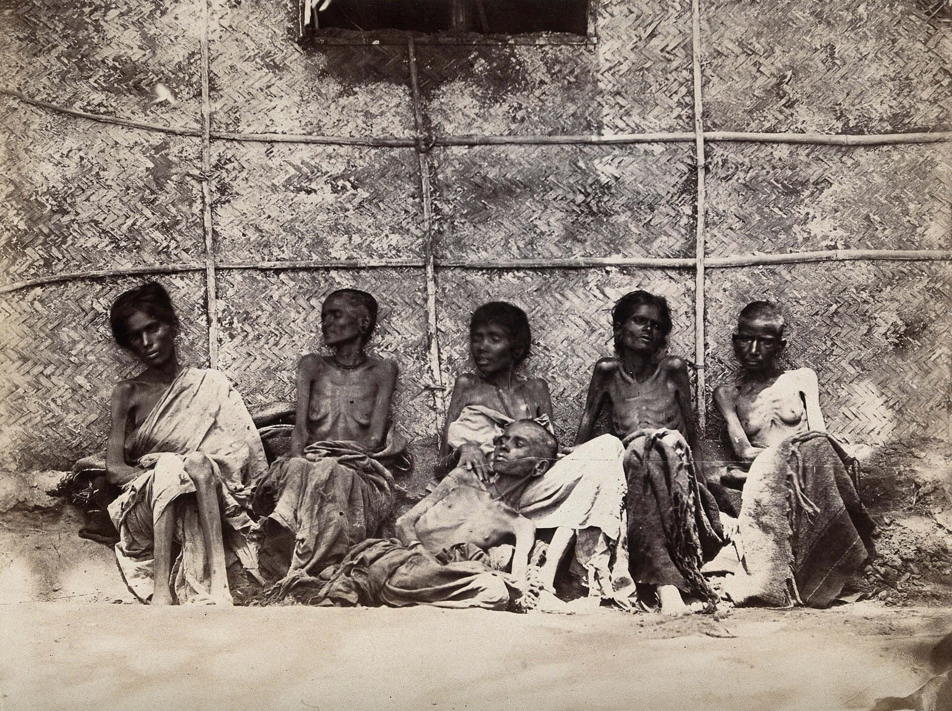 Emaciated Indians Suffering From Famine Background