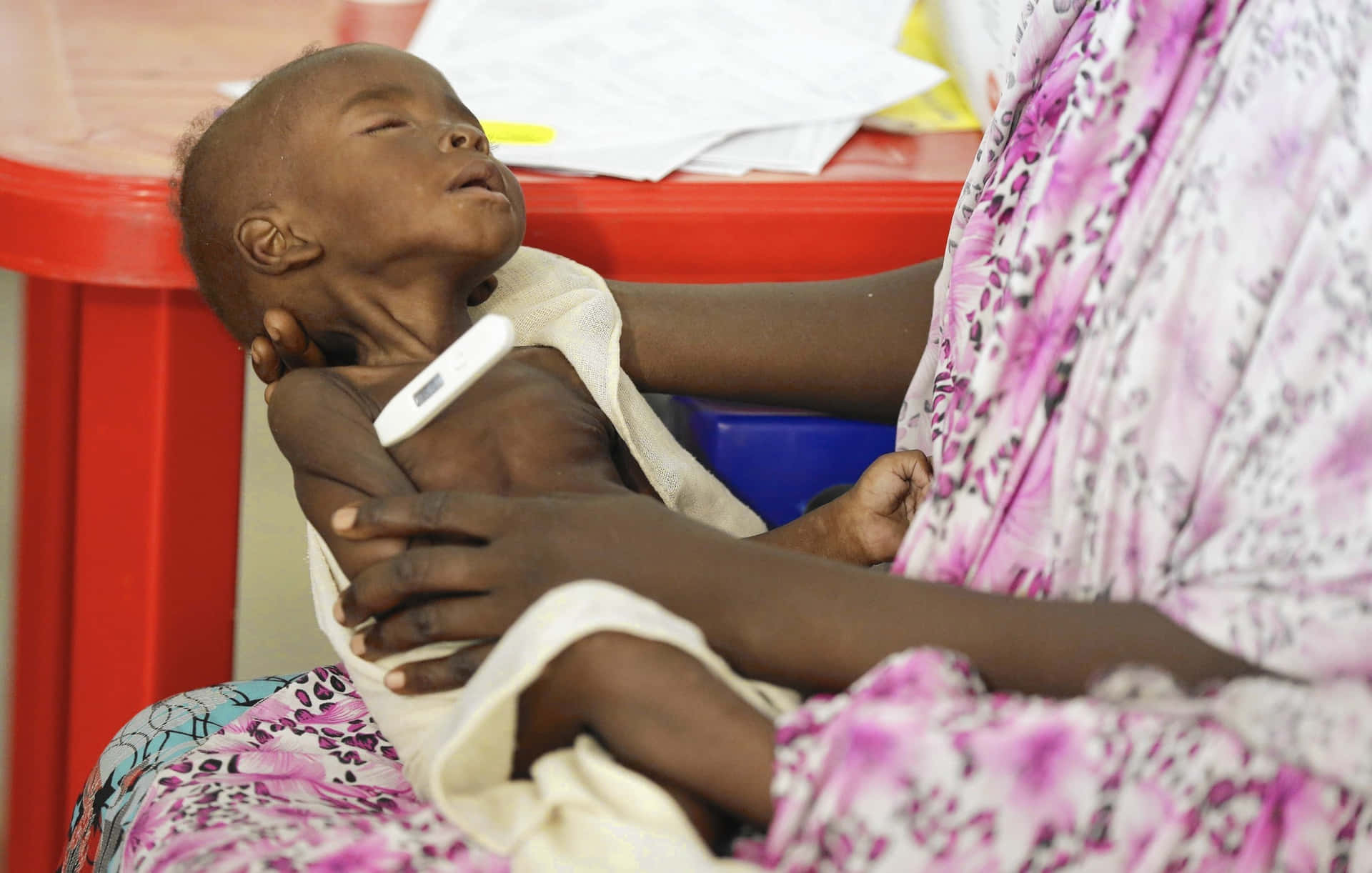 Emaciated Sleeping Child