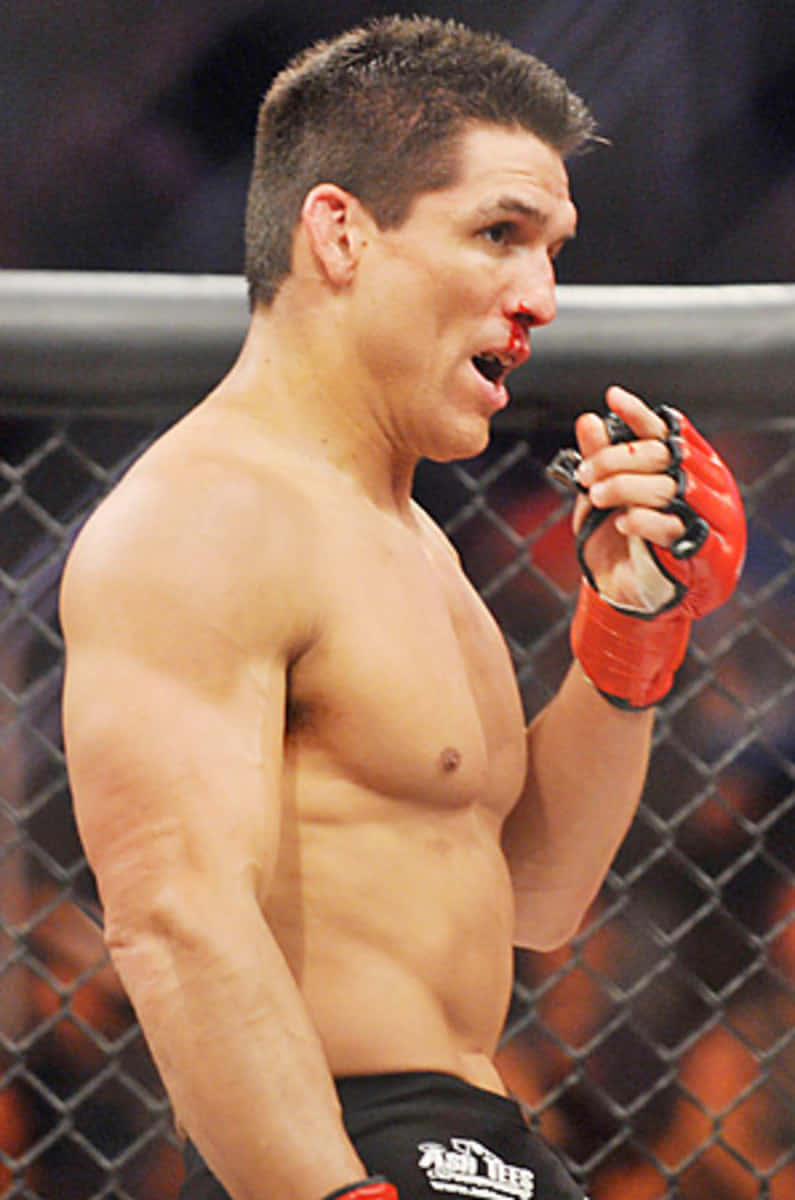 Frank Shamrock With A Bloody Nose