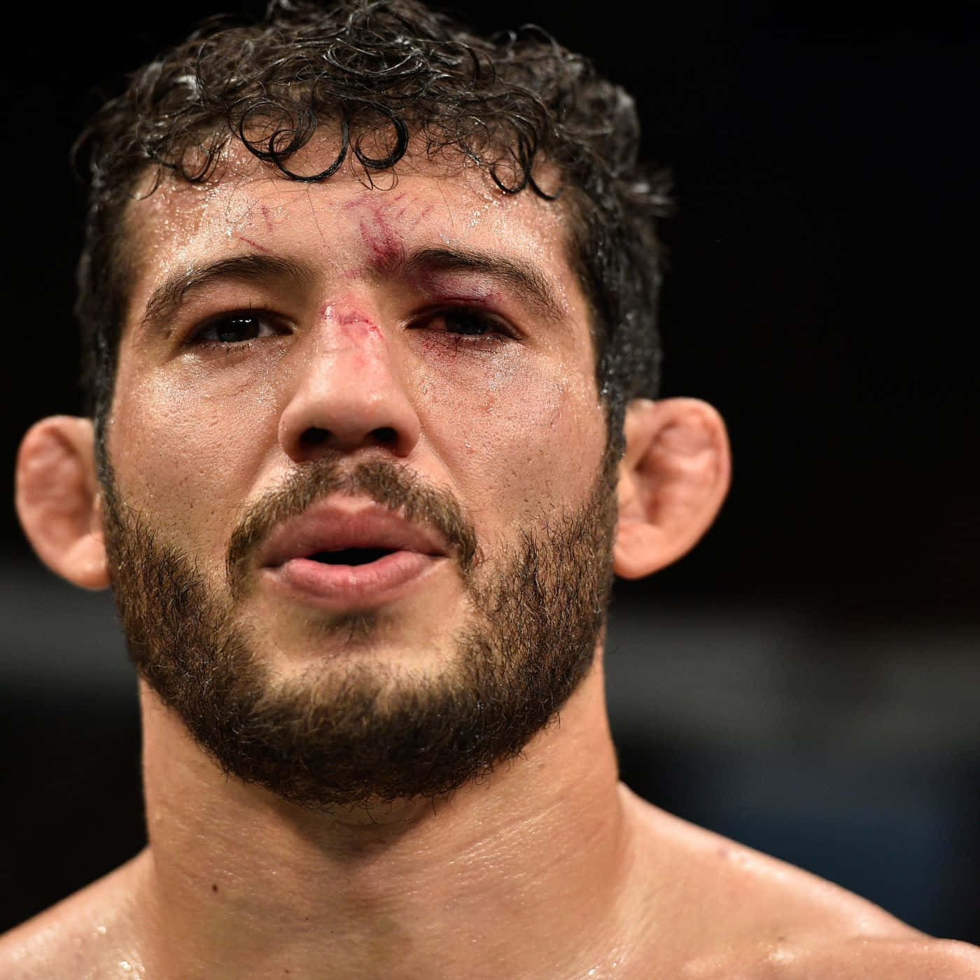 Gilbert Melendez Candid Headshot Left Eye Injury Background