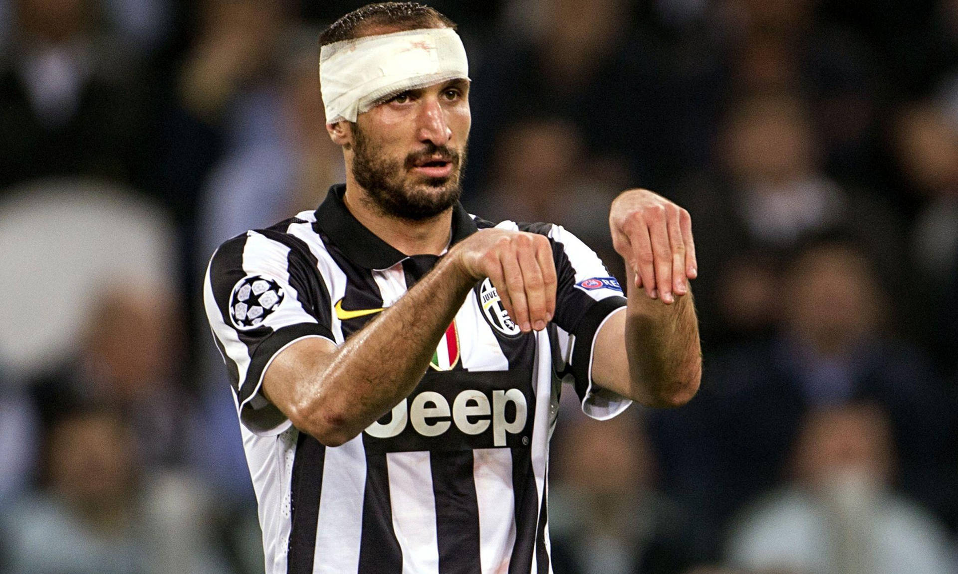 Giorgio Chiellini Juventus Fc Head Injury Hands Background