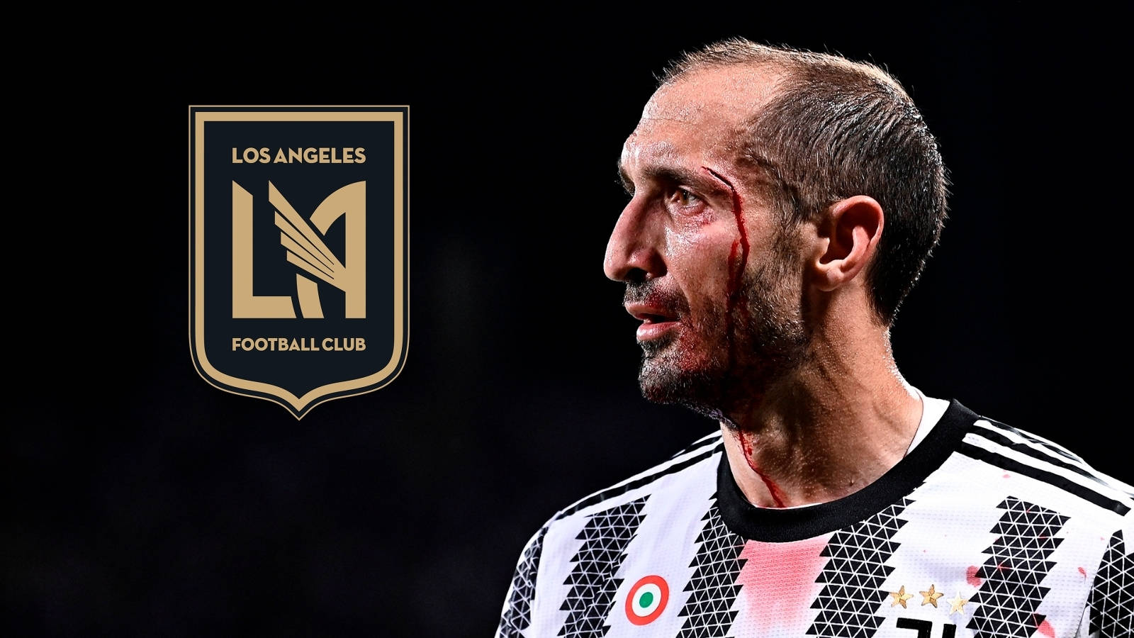 Giorgio Chiellini Los Angeles Football Bleeding Injury