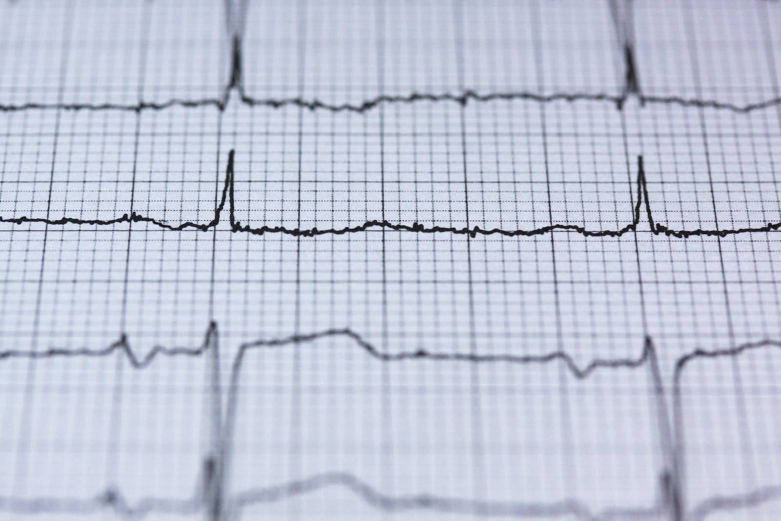 Heartbeat Black Graph Background
