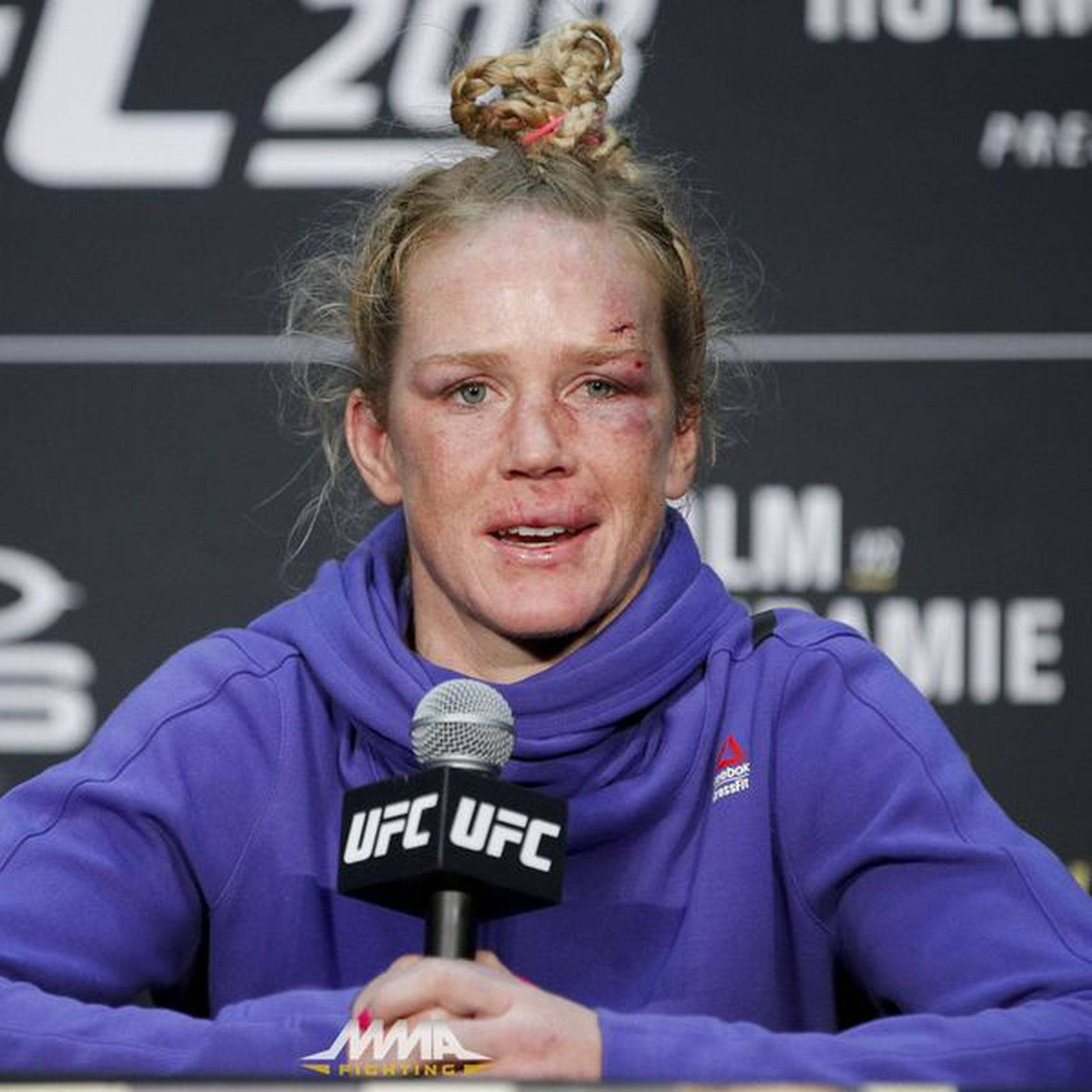 Holly Holm Bruised Face Background