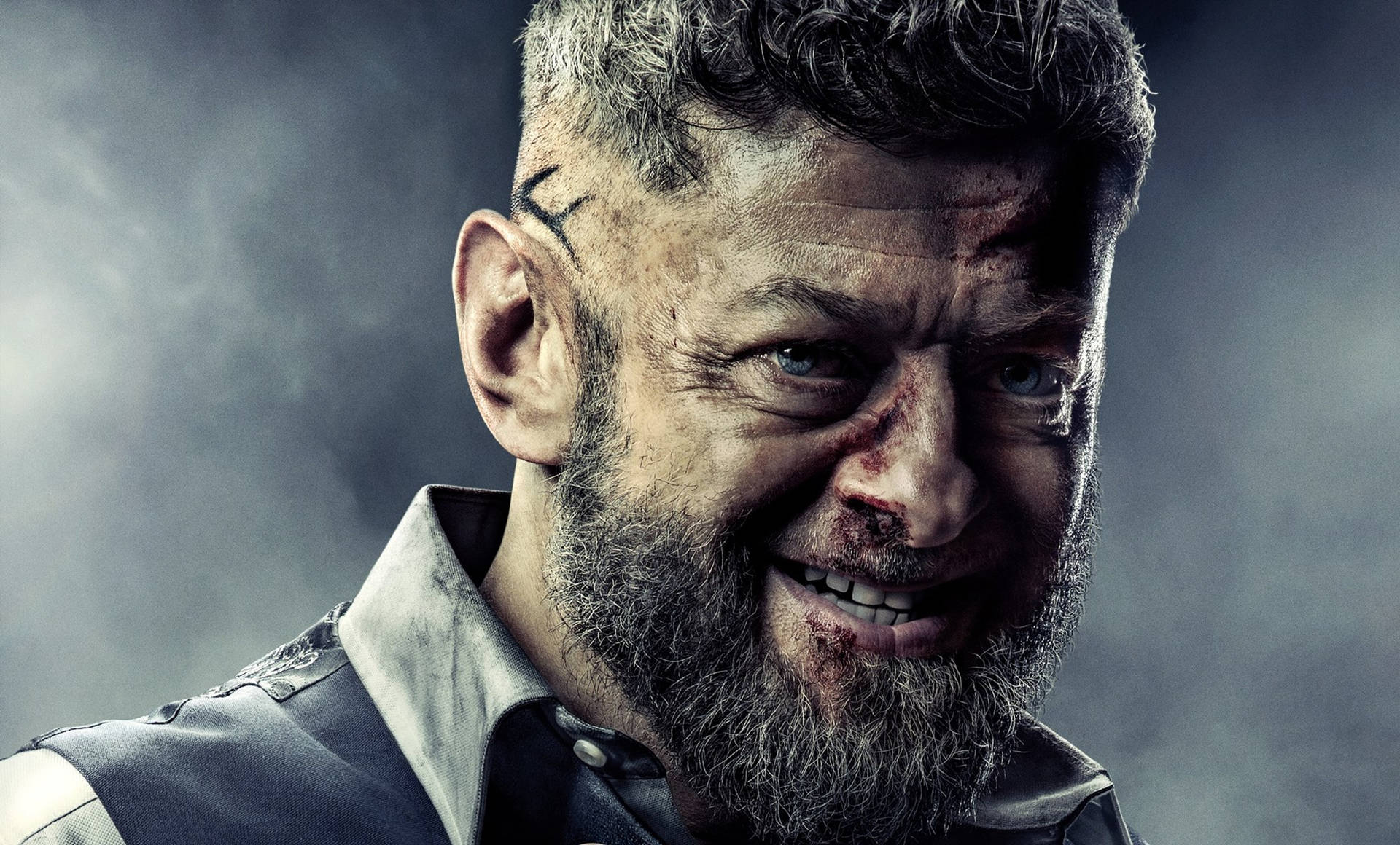 Injured Andy Serkis Background