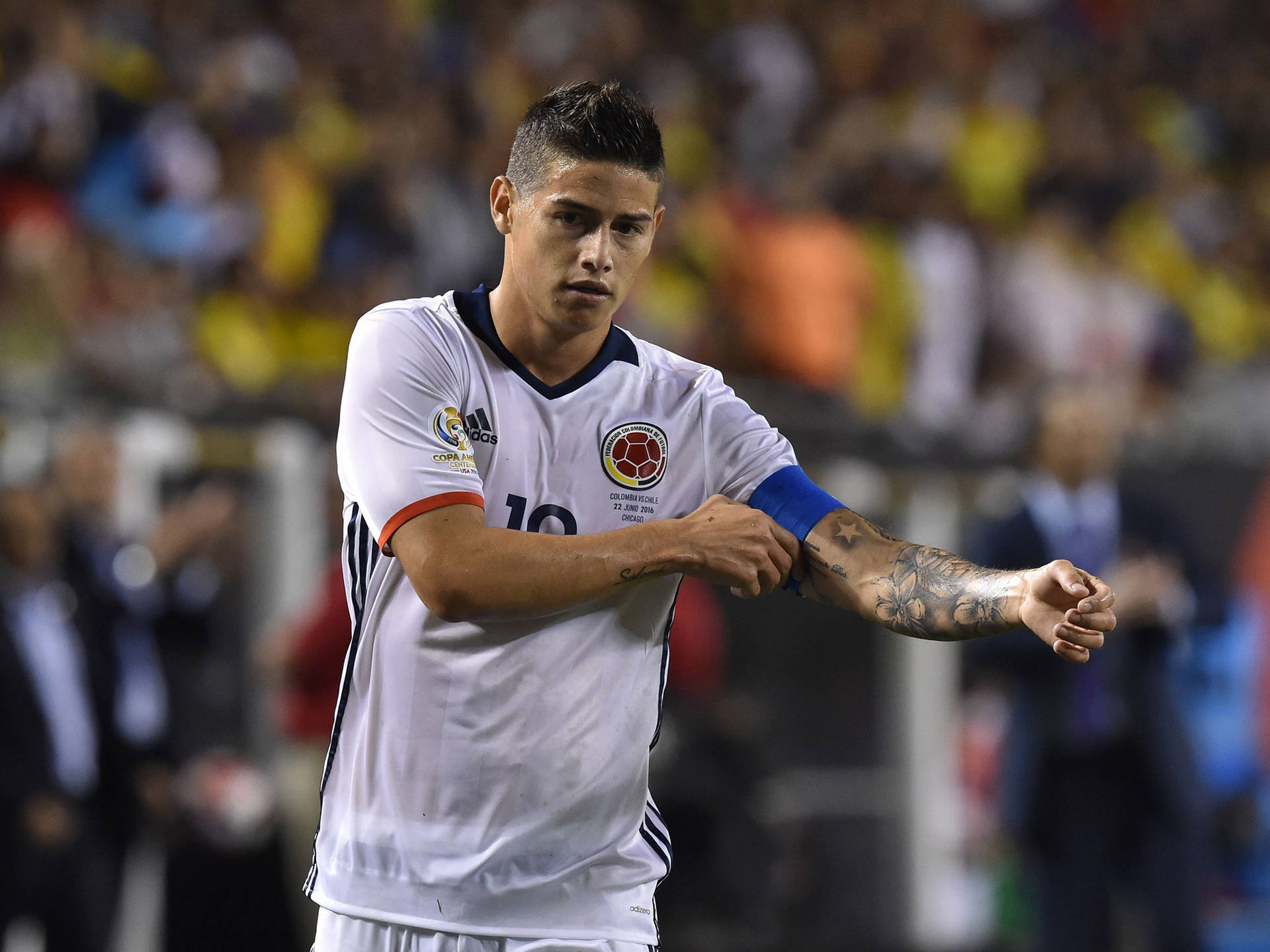 Injured James Rodriguez Arm