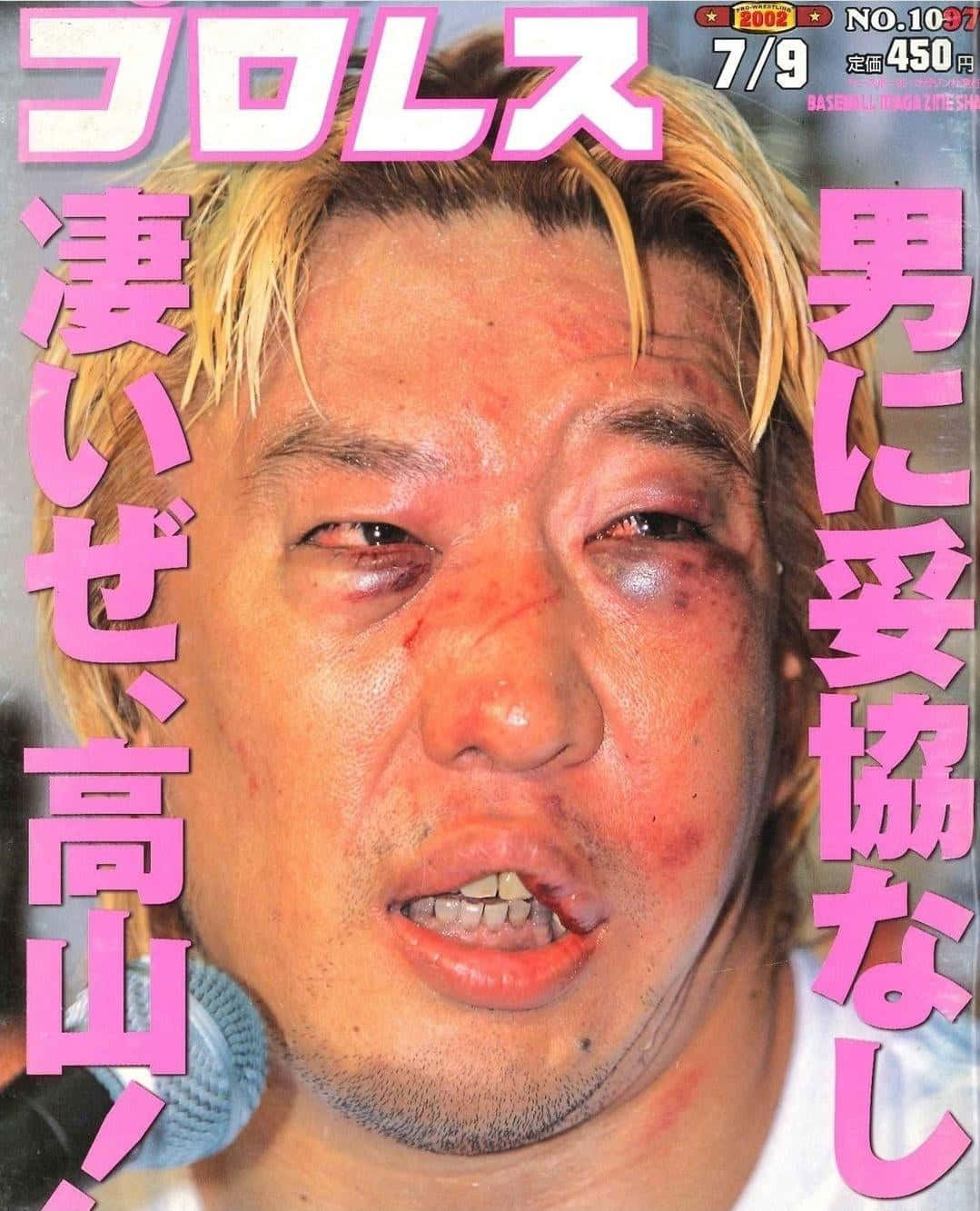 Injured Yoshihiro Takayama In Magazine Background